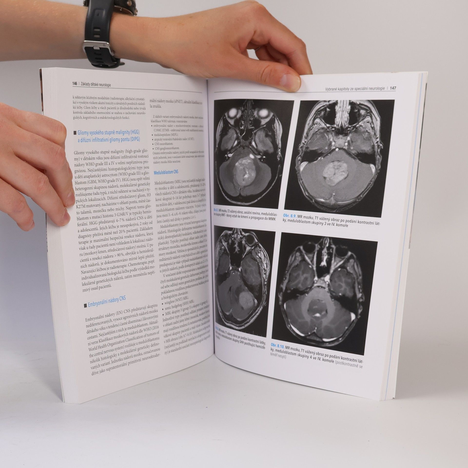 Pavel Kršek Základy dětské neurologie