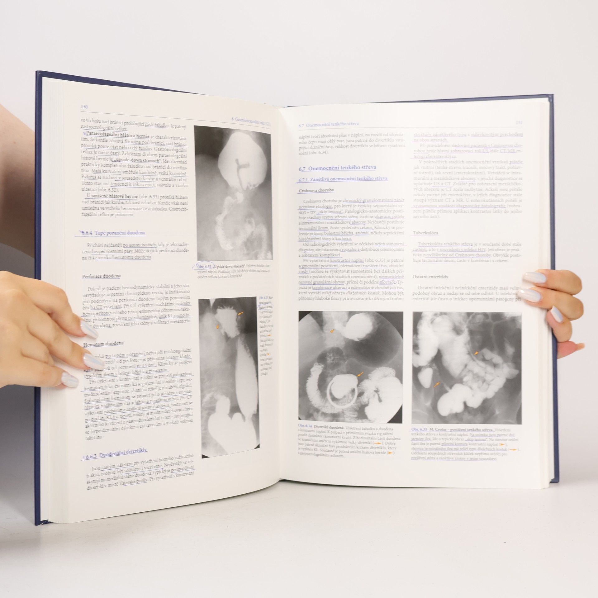 Miroslav Heřman Základy radiologie