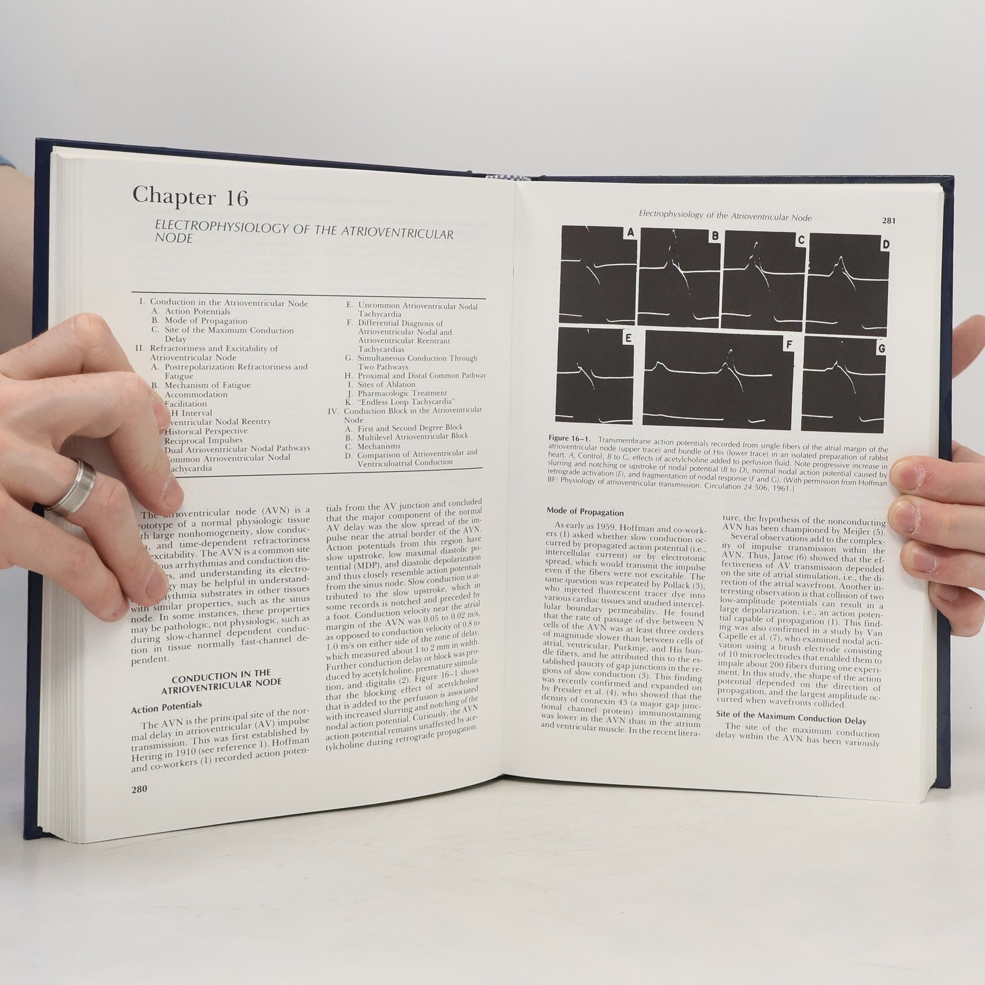 Borys Surawicz Electrophysiologic Basis of ECG and Cardiac Arrhythmias