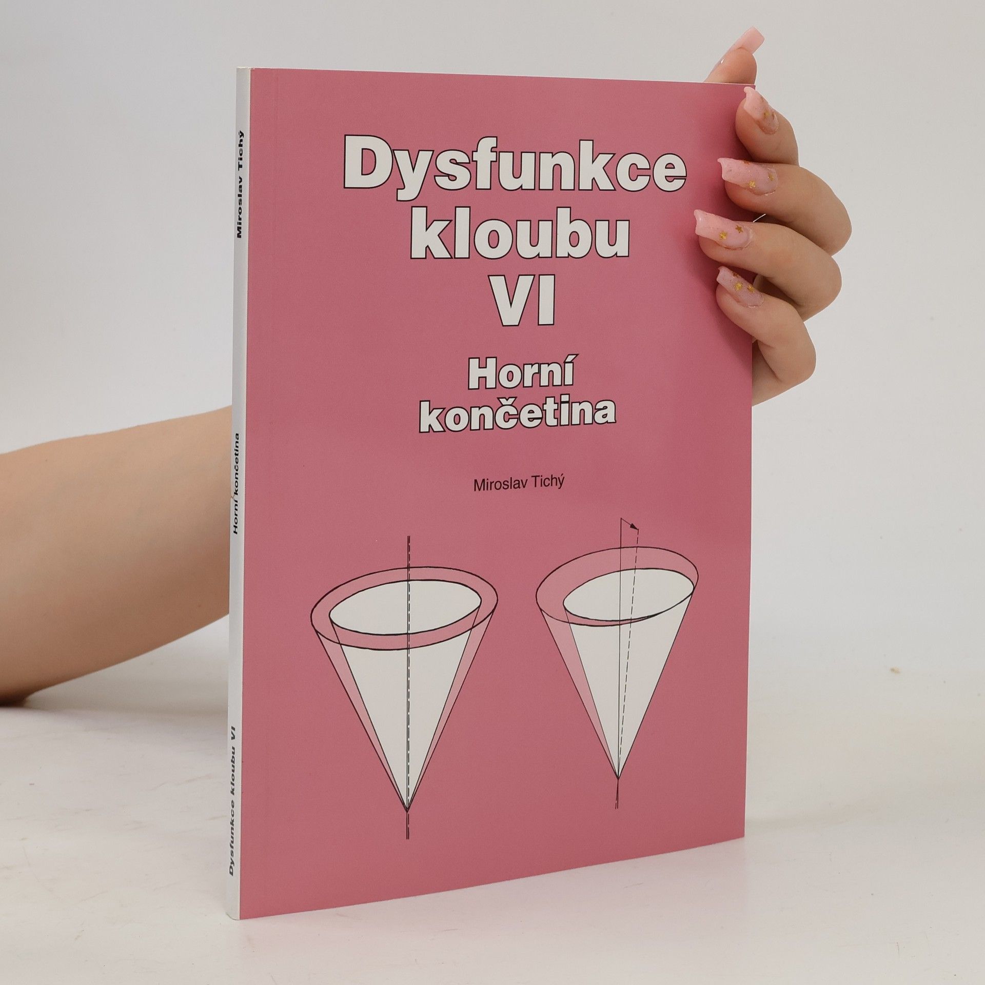 Dysfunkce kloubu VI. Horní končetina