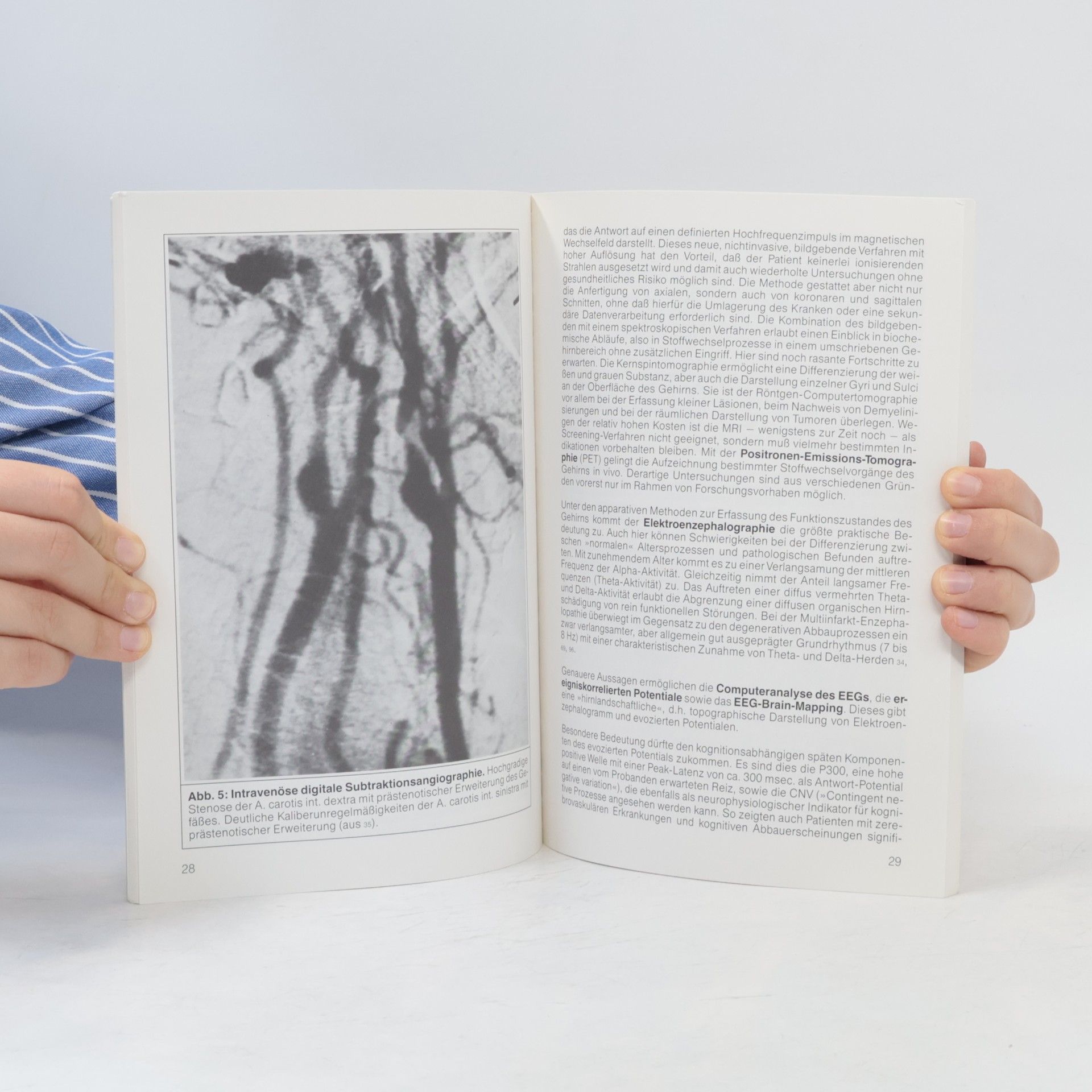 Gerhart Harrer Das hirnorganische Psychosyndrom