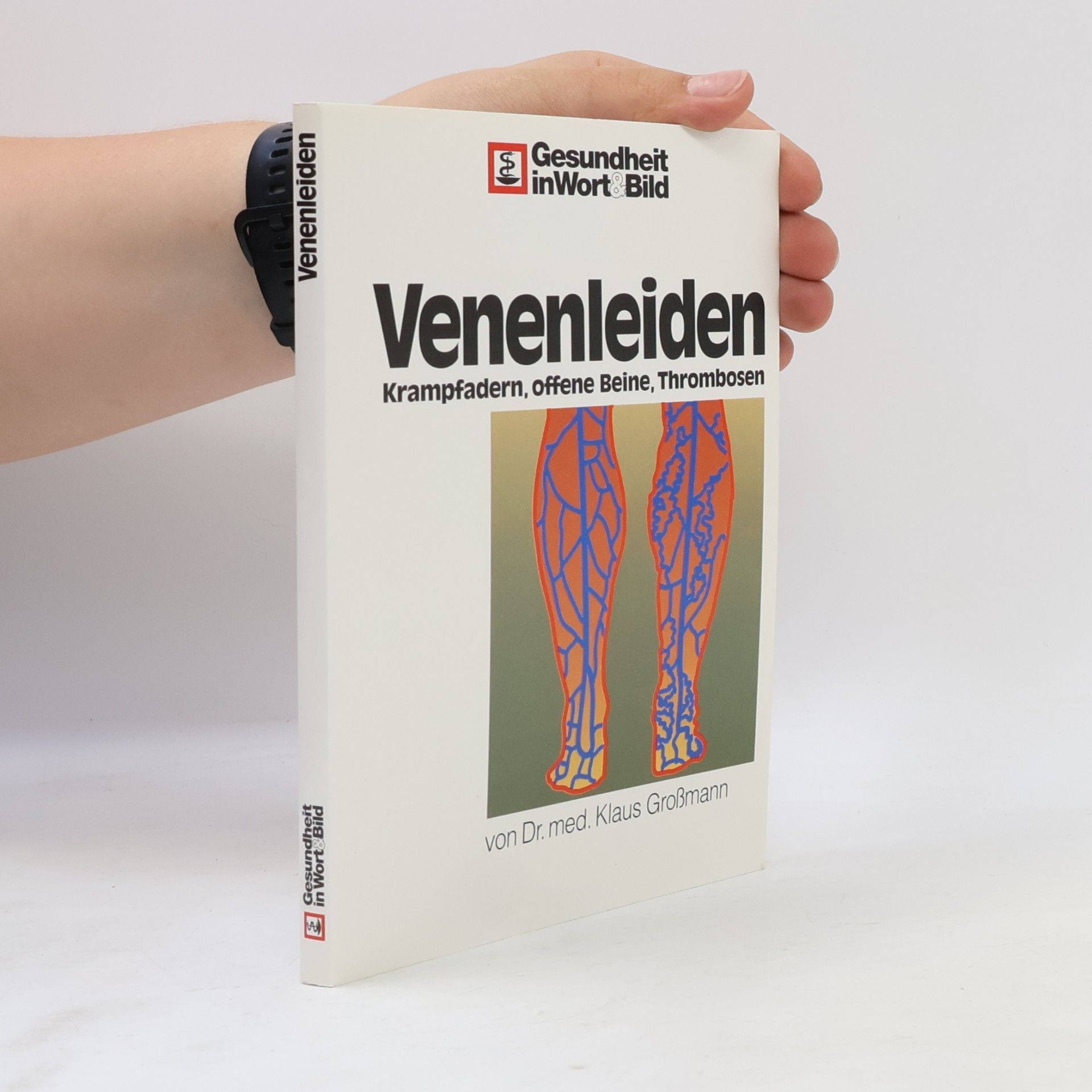 Klaus Großmann Venenleiden. Krampfadern, offene Beine und Thrombosen