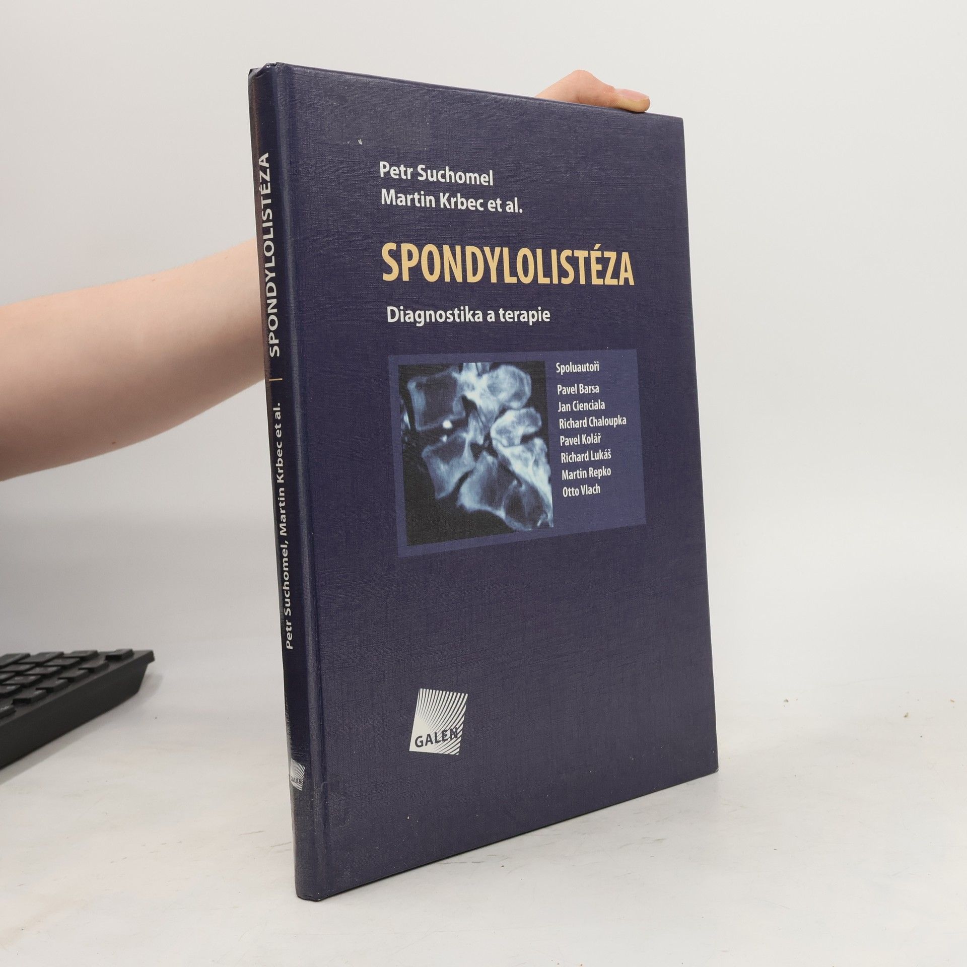 Petr Suchomel Spondylolistéza
