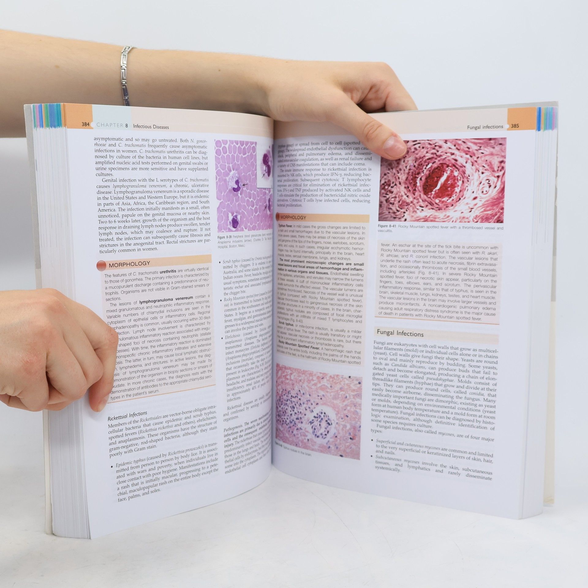 Abul K. Abbas Robbins & Cotran Pathologic Basis of Disease