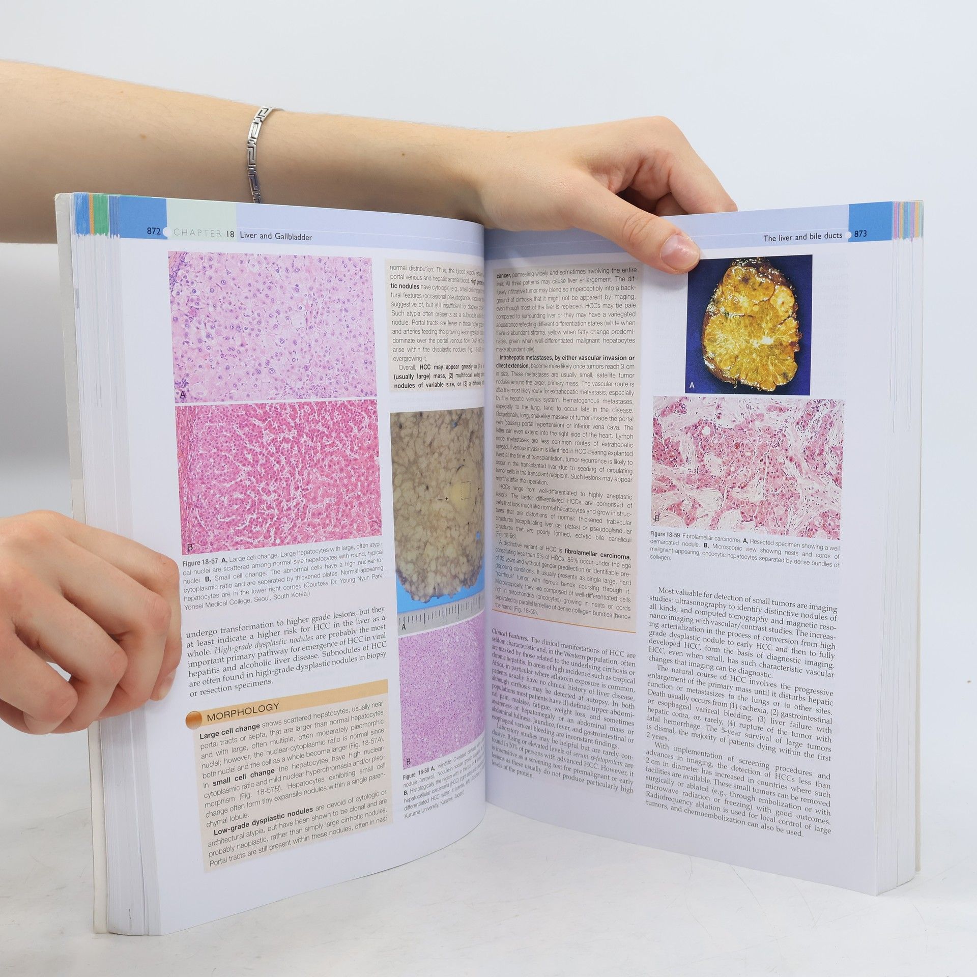 Abul K. Abbas Robbins & Cotran Pathologic Basis of Disease