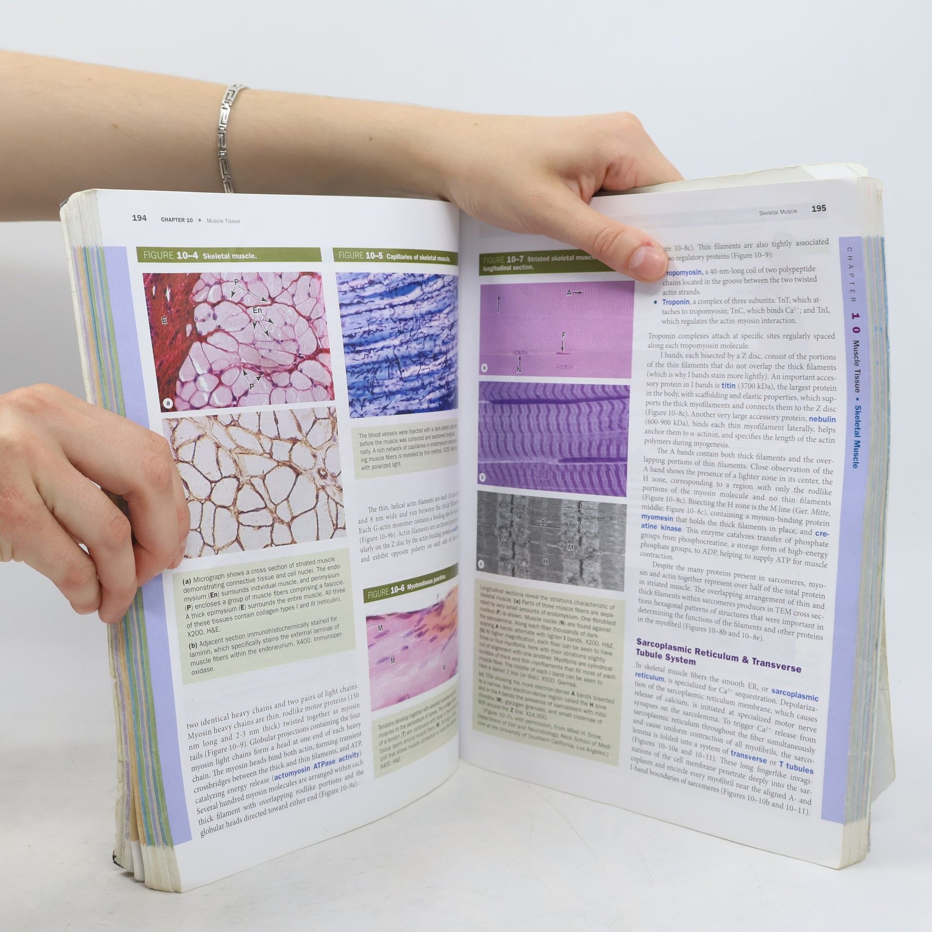 Anthony Mescher Junqueira's Basic Histology. Text & Atlas