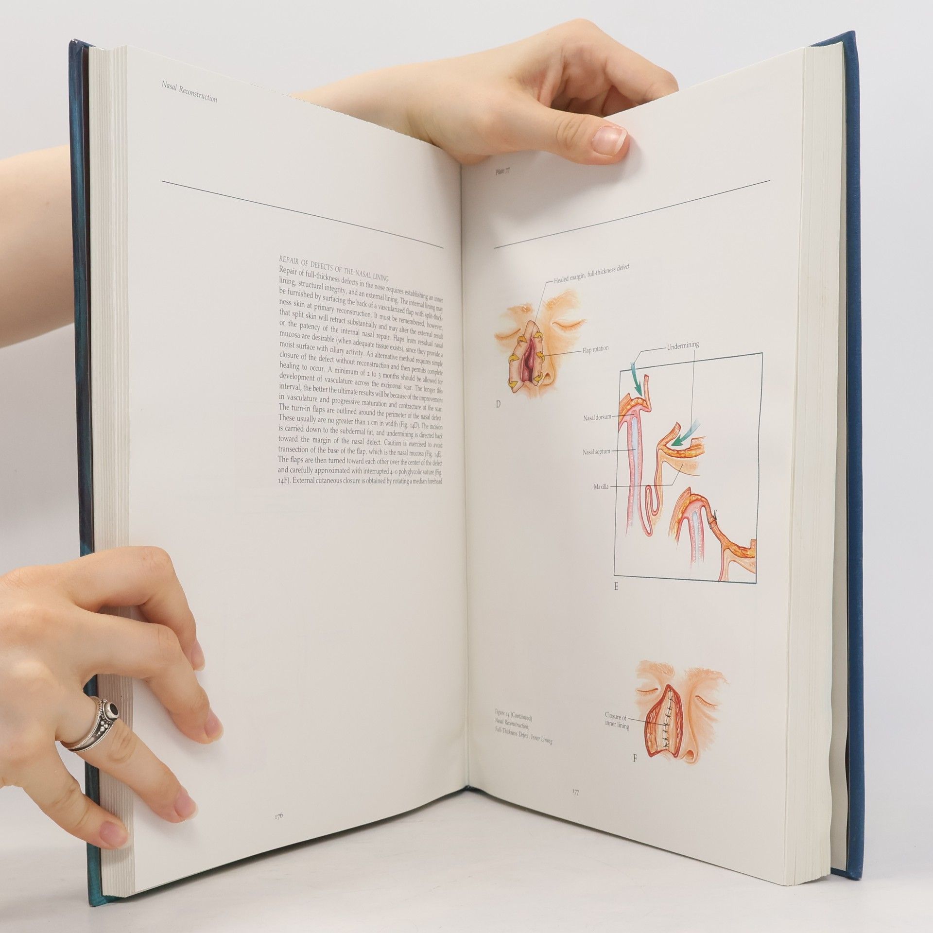 Michael E. Johns Atlas of Head and Neck Surgery vol 1