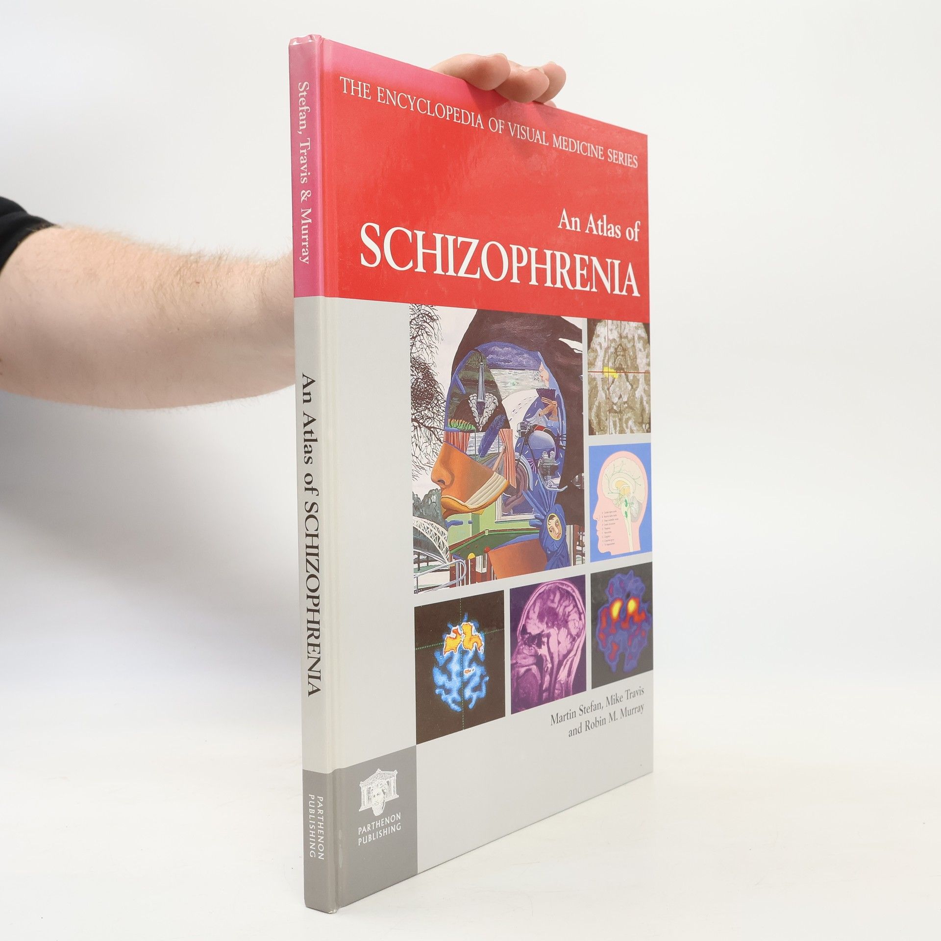 Mike Travis The Encyclopedia of Visual Medicine Series. An Atlas of Schizophrenia