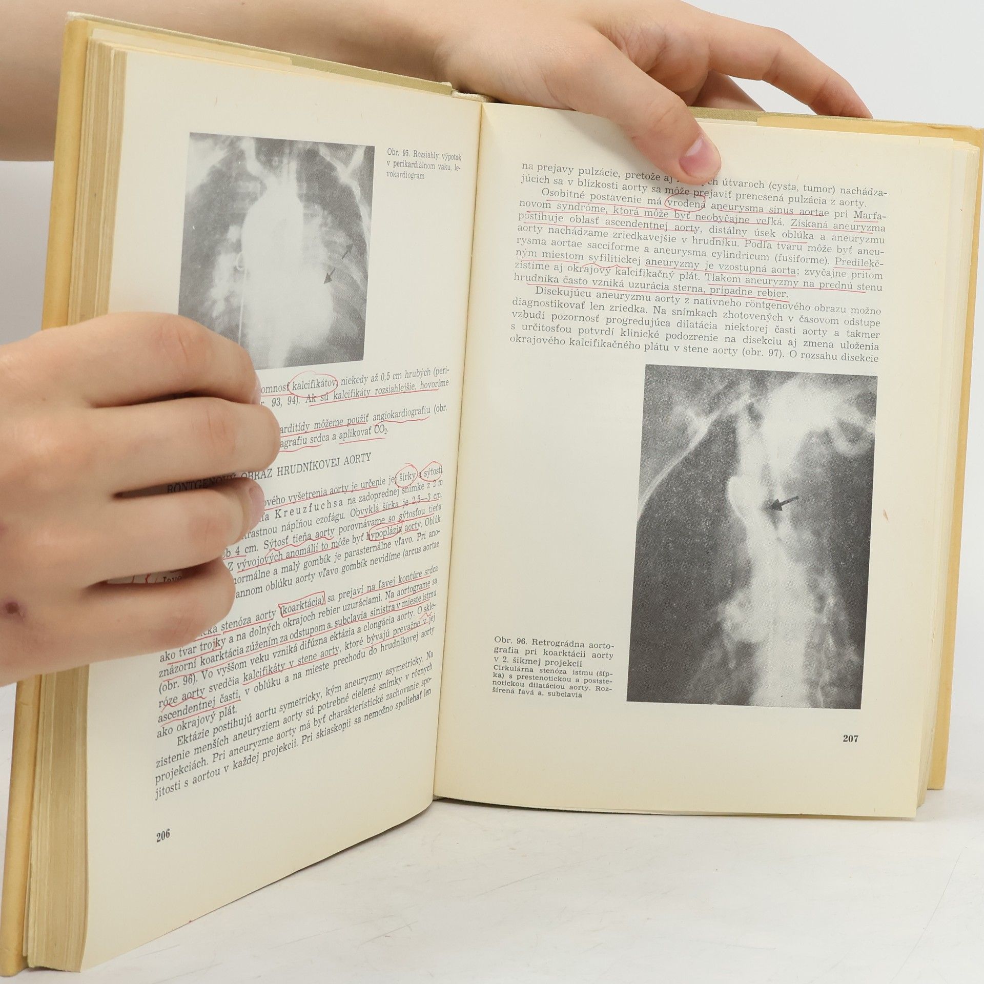 Mikuláš Takáč Základy diagnostiky vo vnútornom lekárstve