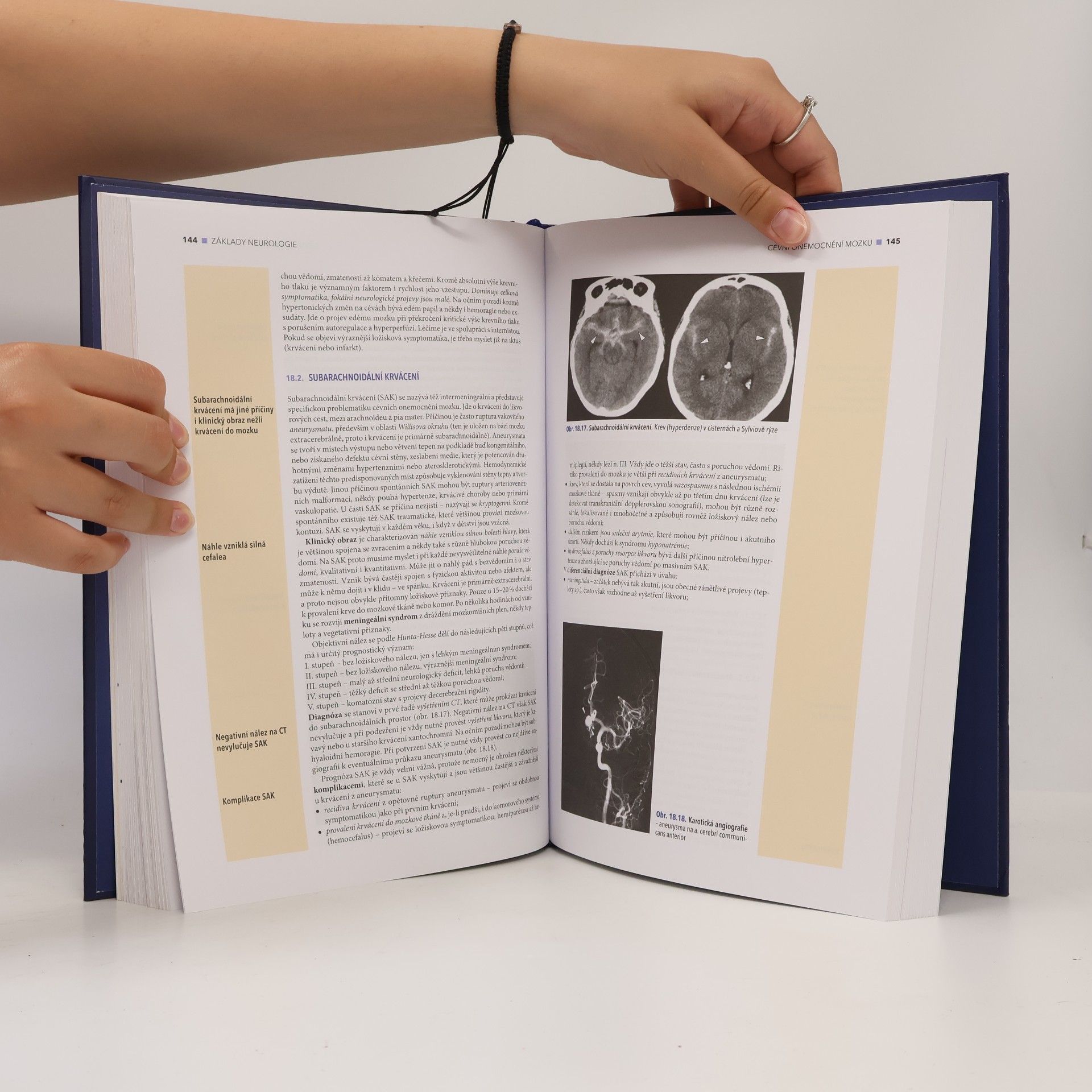 Zdeněk Ambler Základy neurologie