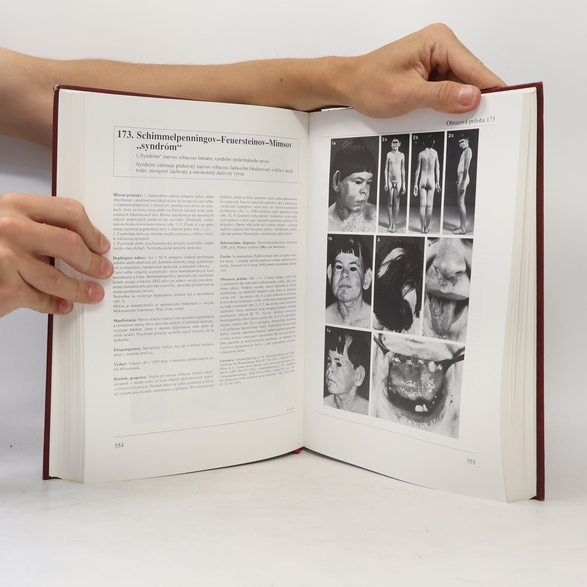 Hans-Rudolf Wiedemann Atlas klinických syndrómov pre kliniku a prax