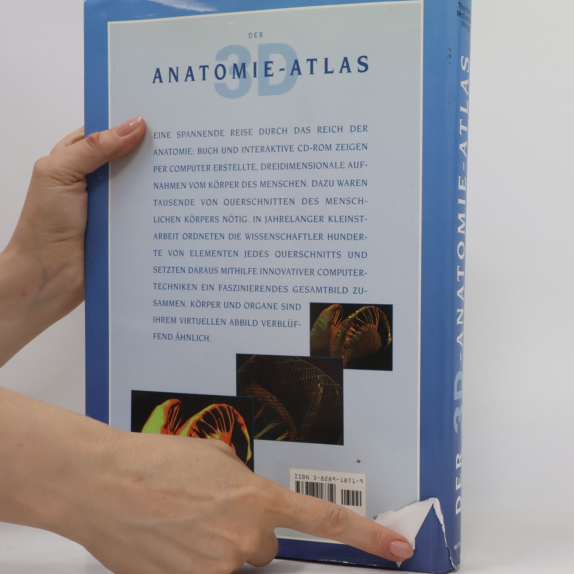 Thomas O. McCracken Der 3D Anatomie Atlas
