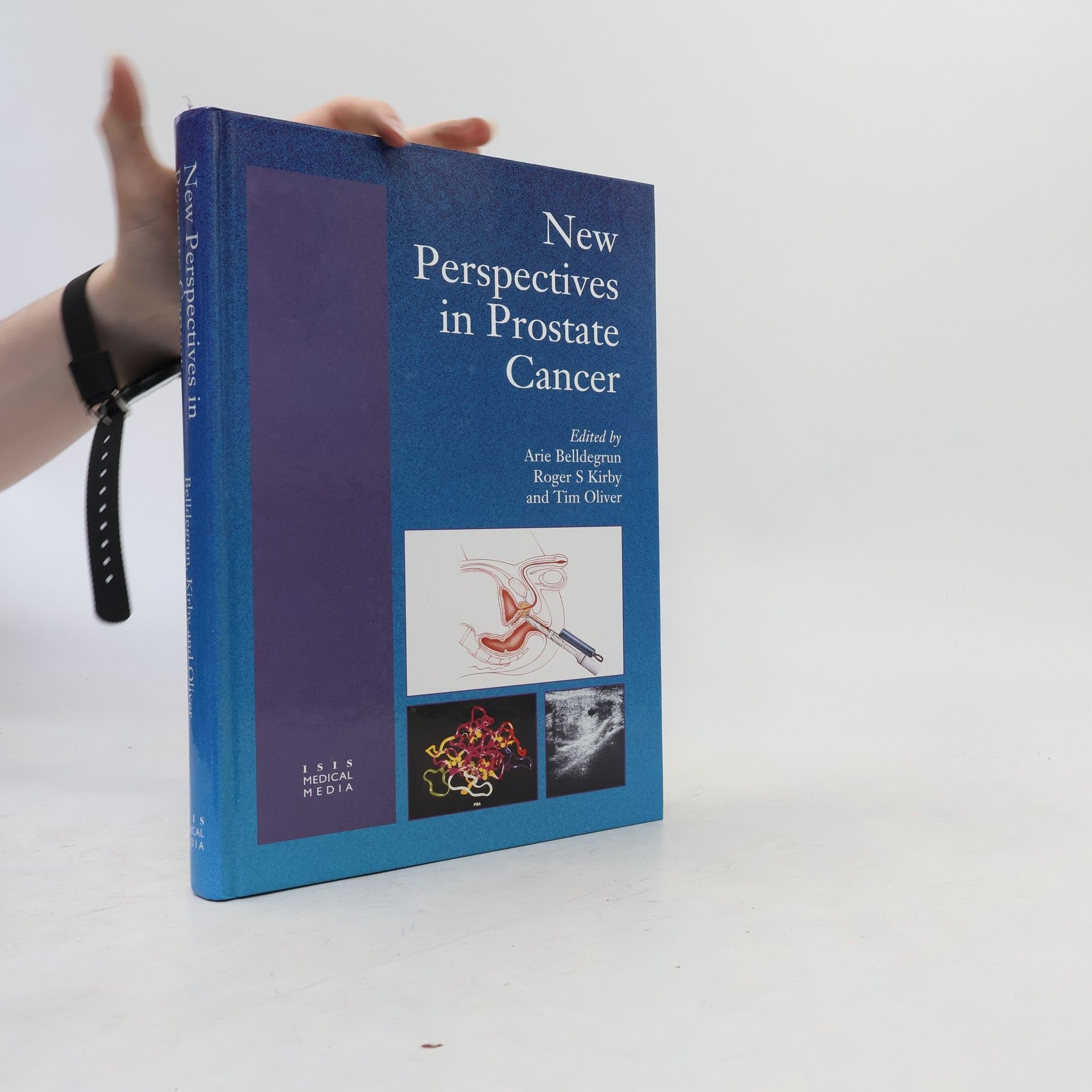 Arie Belldegrun New Perspectives in Prostate Cancer