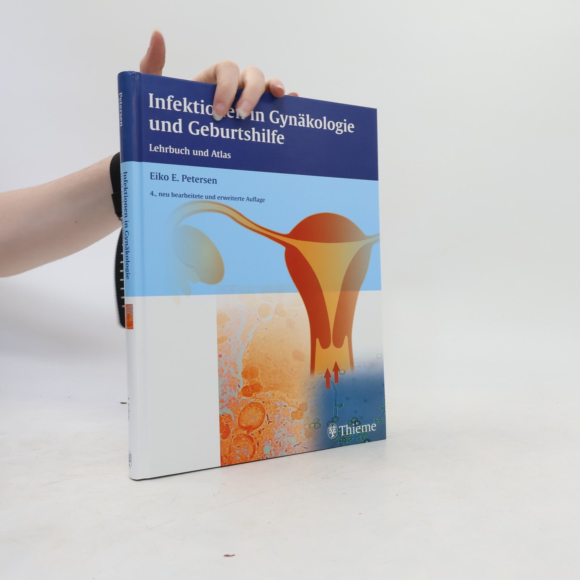 Infektionen in Gynäkologie und Geburtshilfe