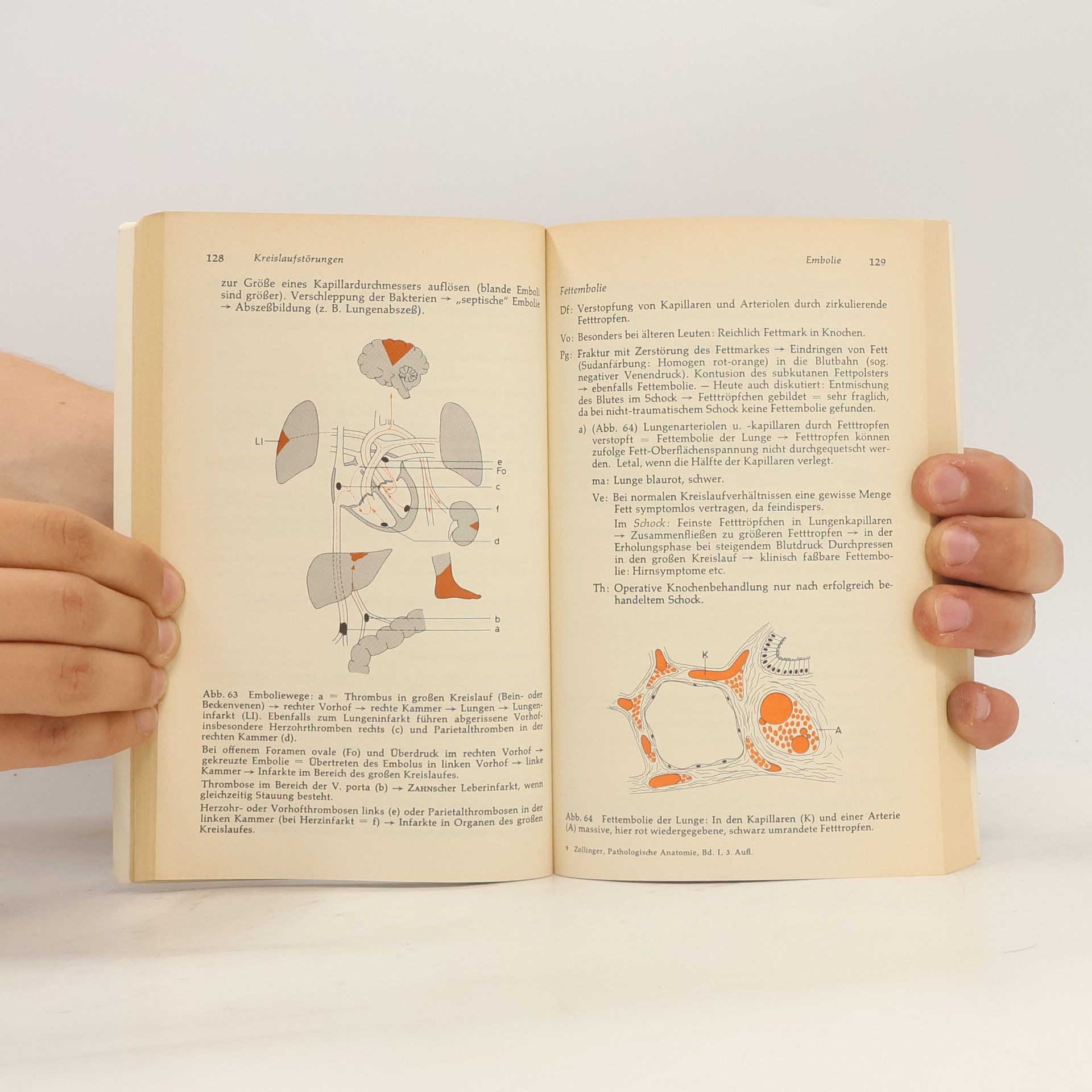 Hans Ulrich Zollinger Pathologische Anatomie