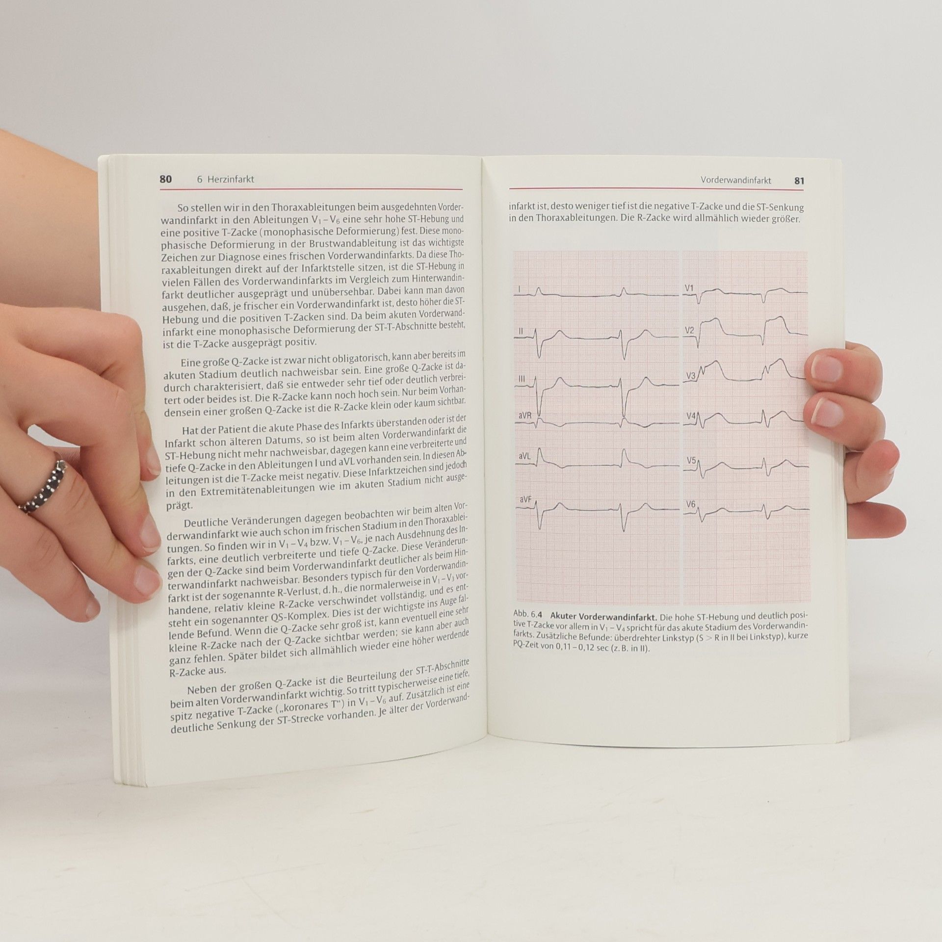 Cook Sup So Praktische EKG-Deutung
