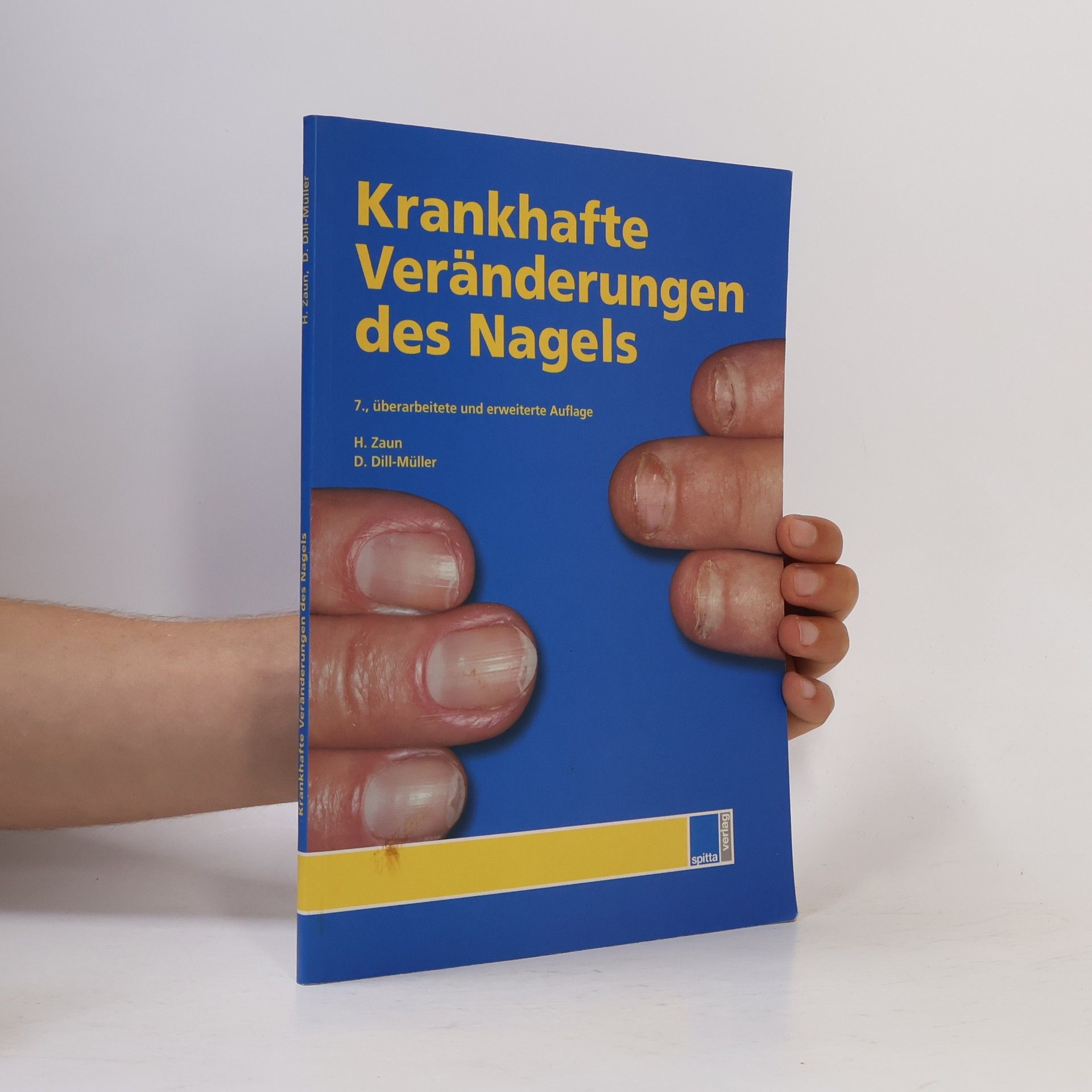 Dorothee Dill-Müller Krankhafte Veränderungen des Nagels