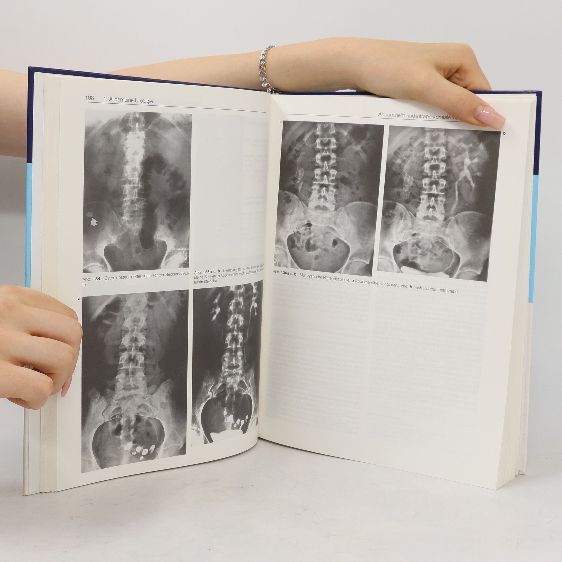 Joachim W. Thüroff Urologische Differentialdiagnose