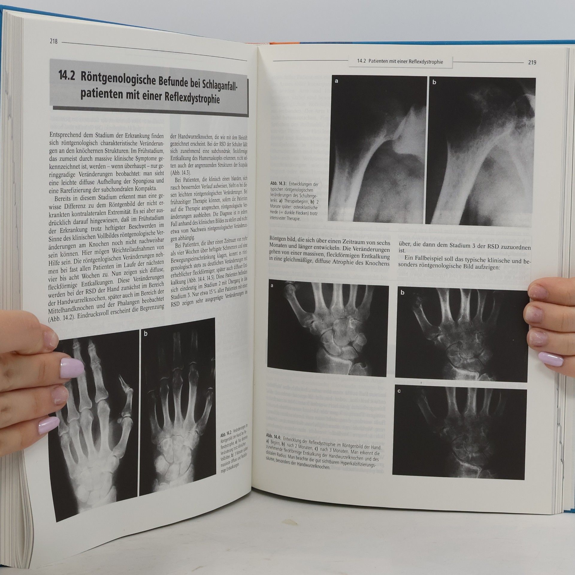 Frank L. Welter Neurologische Rehabilitation