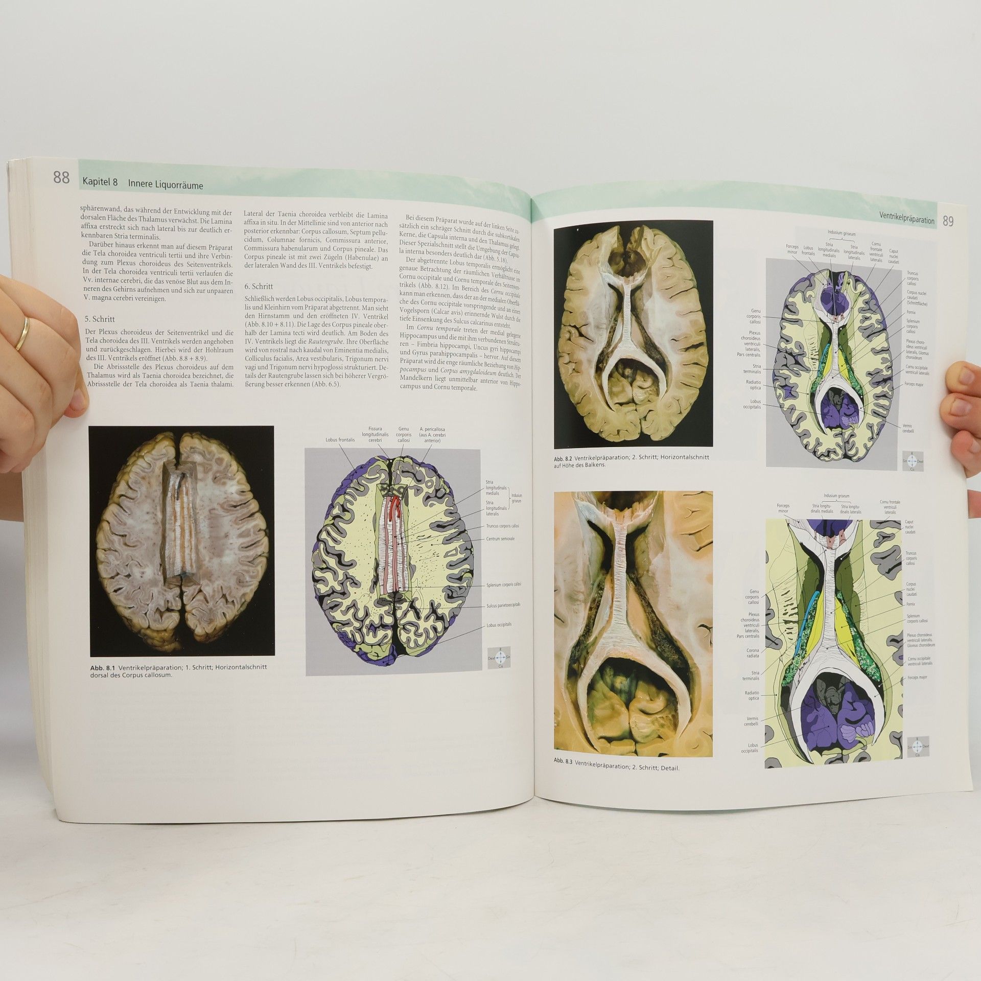 Thomas Deller Fotoatlas Neuroanatomie