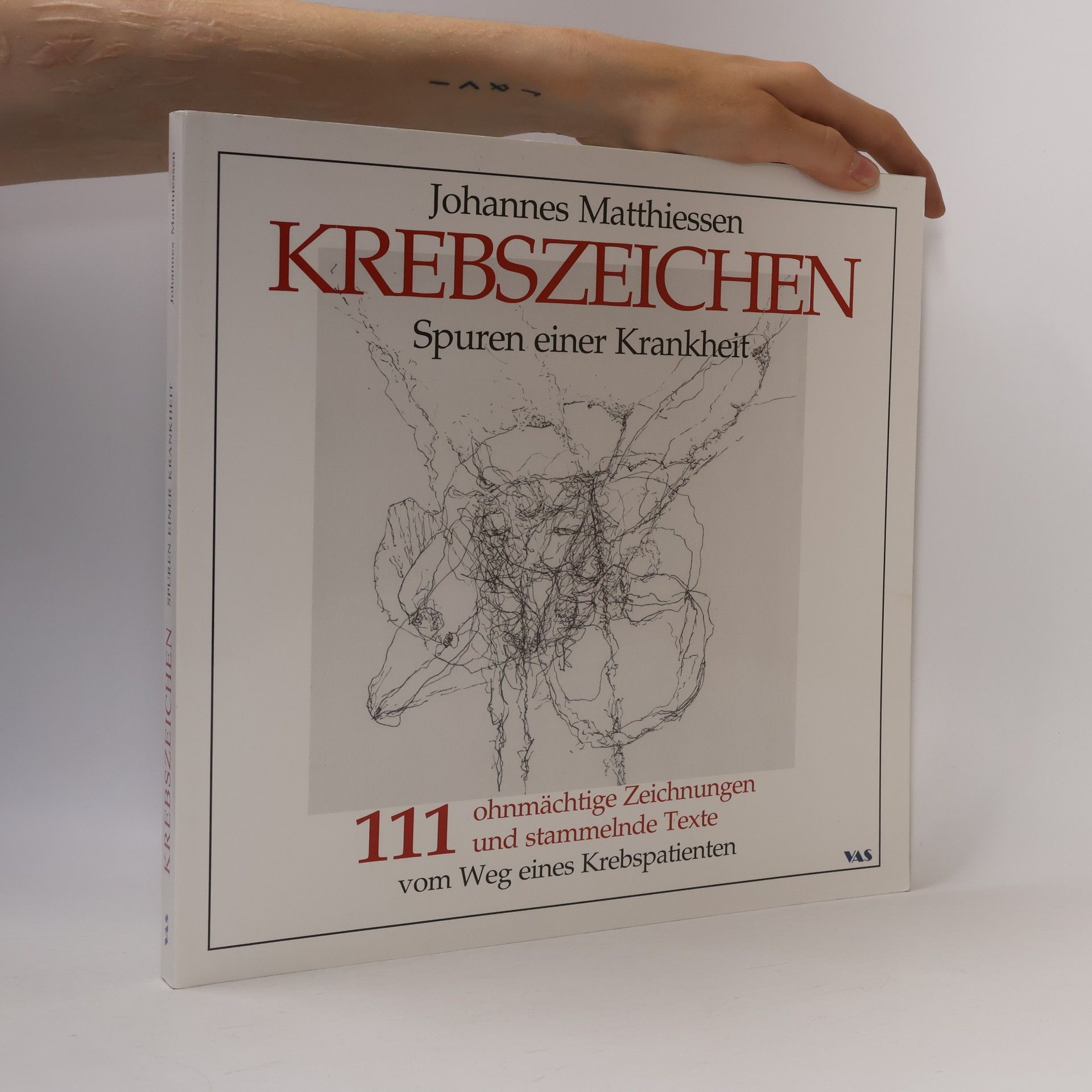 Johannes Matthiessen Krebszeichen - Spuren einer Krankheit
