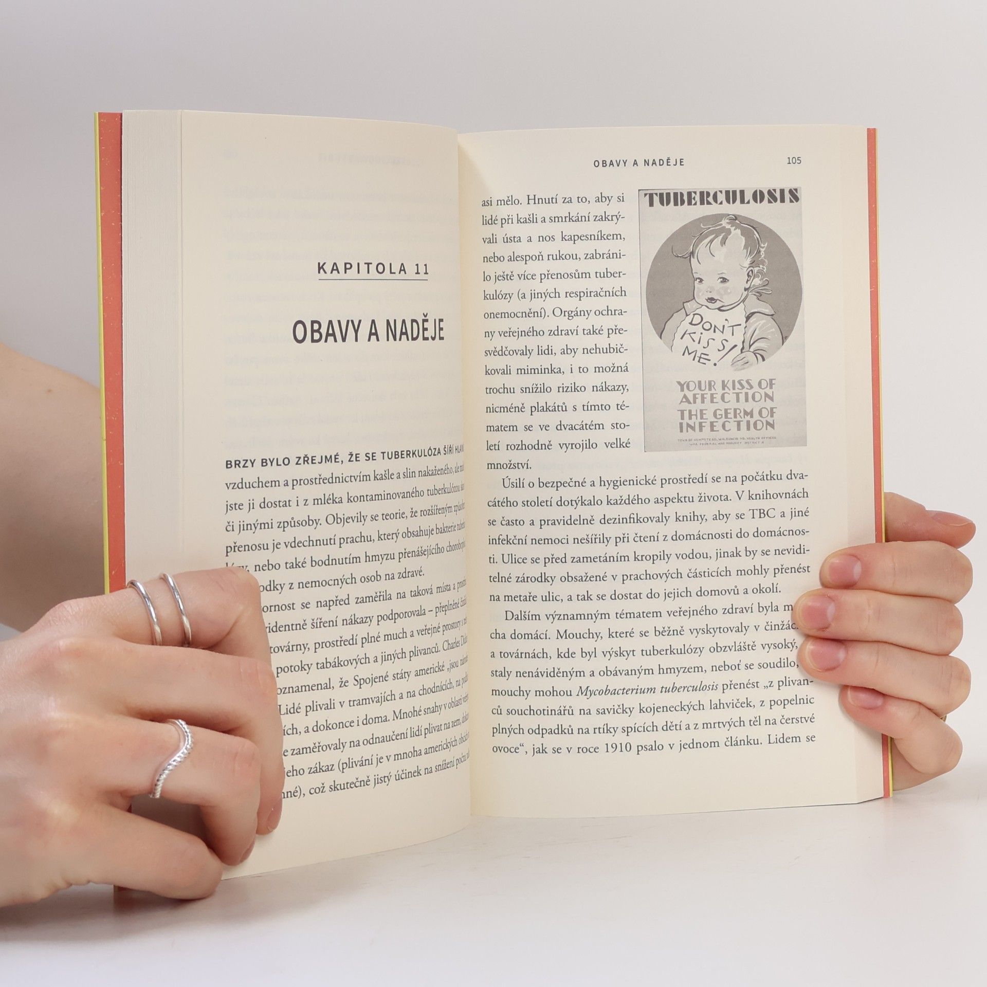 John Green Všechno je tuberkulóza