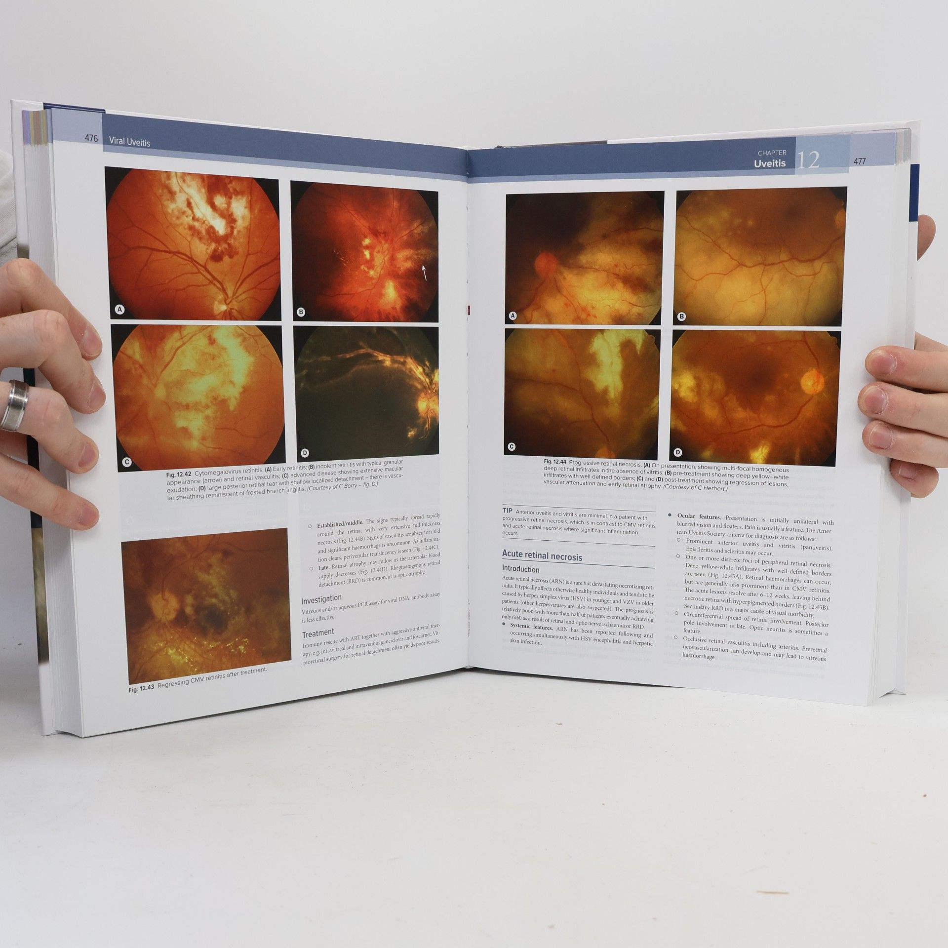 John F. Salmon MD FRCS FRCOphth Kanski's Clinical Ophthalmology