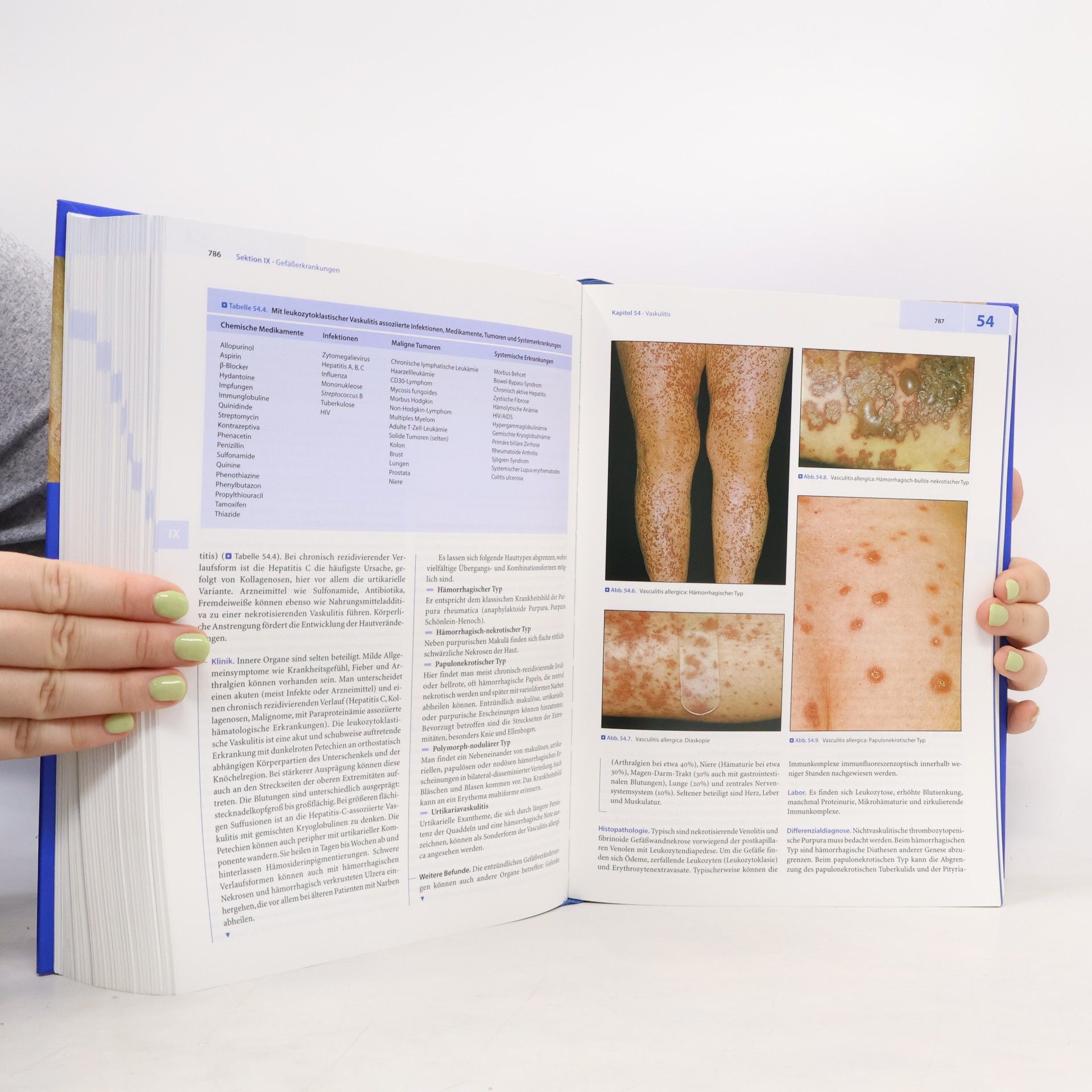 Otto Braun-Falco Dermatologie und Venerologie
