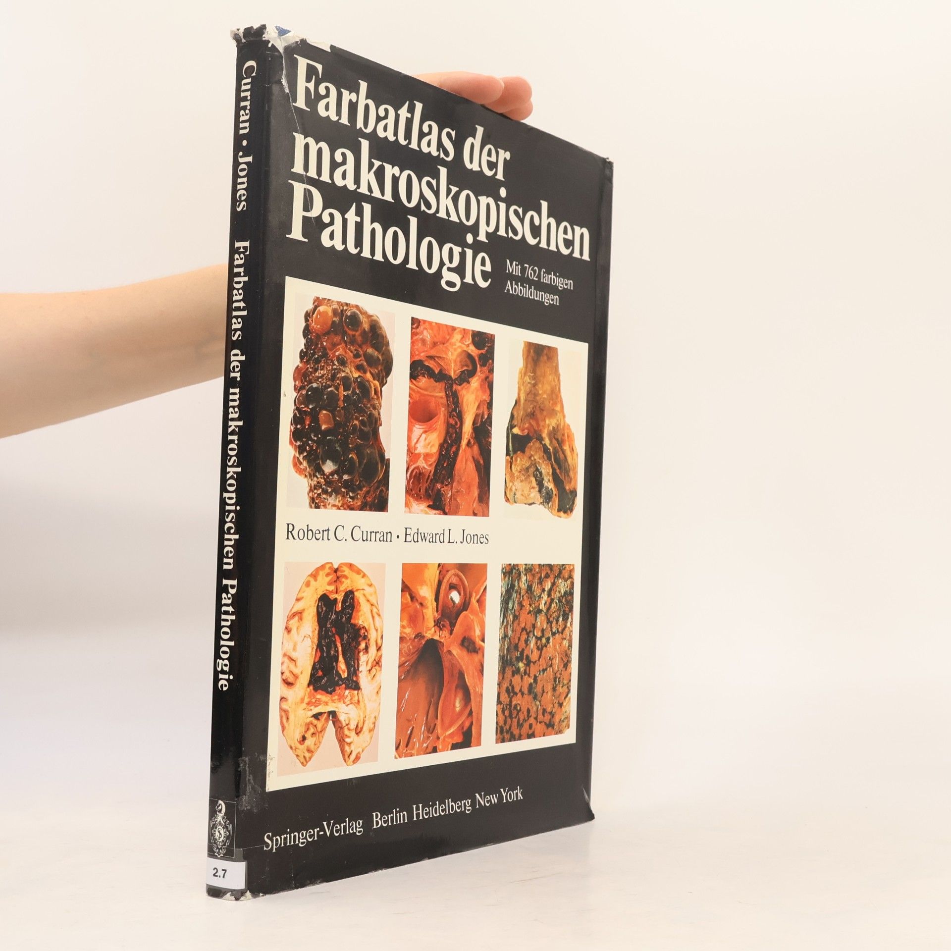 Edward L. Jones Farbatlas der makroskopischen Pathologie