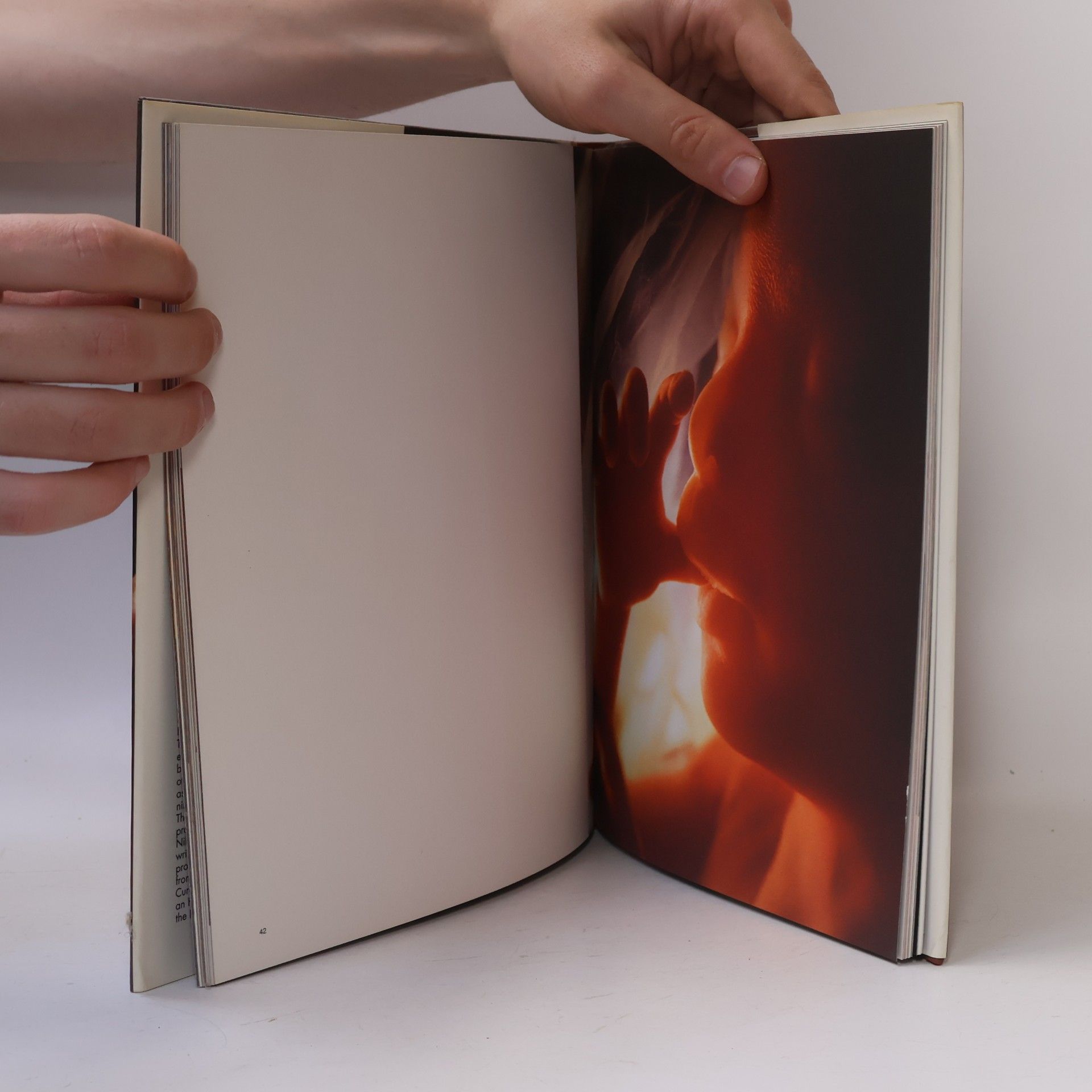 Lennart Nilsoon Lennart Nilsson: Images of Life