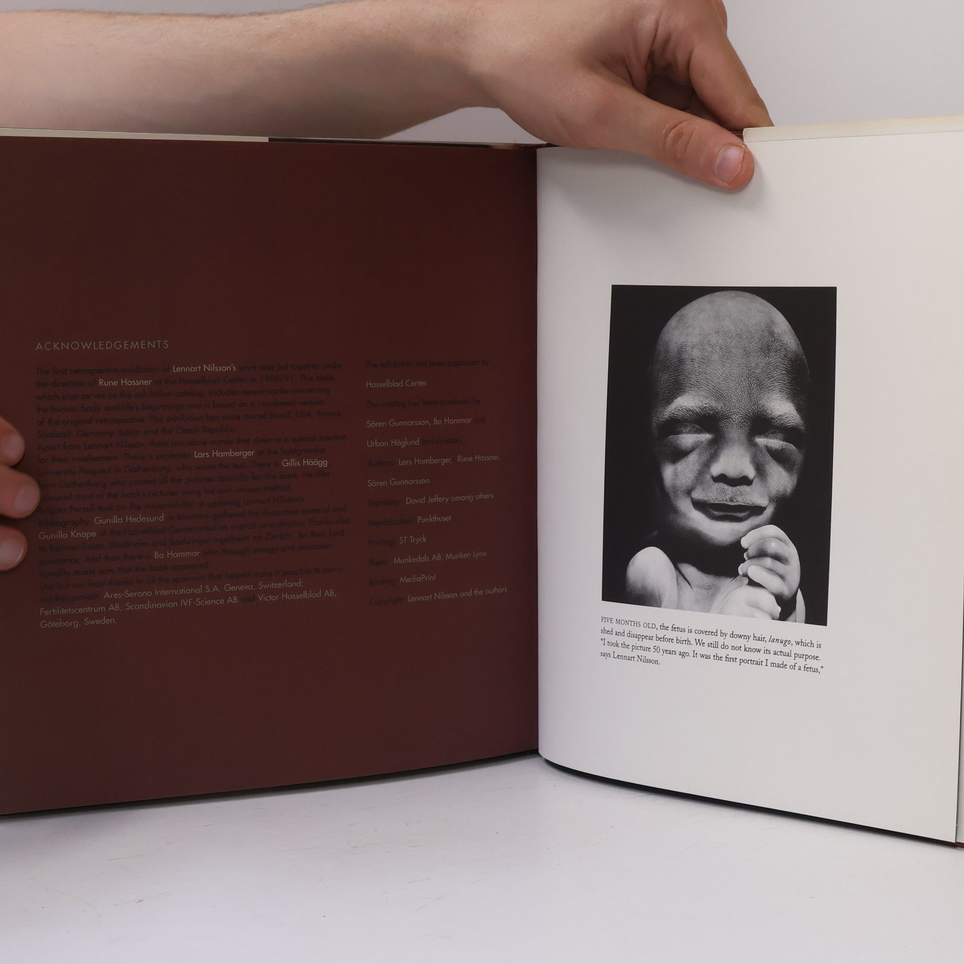 Lennart Nilsoon Lennart Nilsson: Images of Life