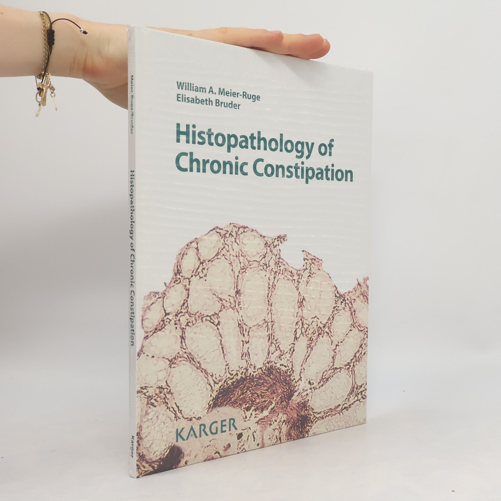 William A. Meier-Ruge Histopathology of Chronic Constipation