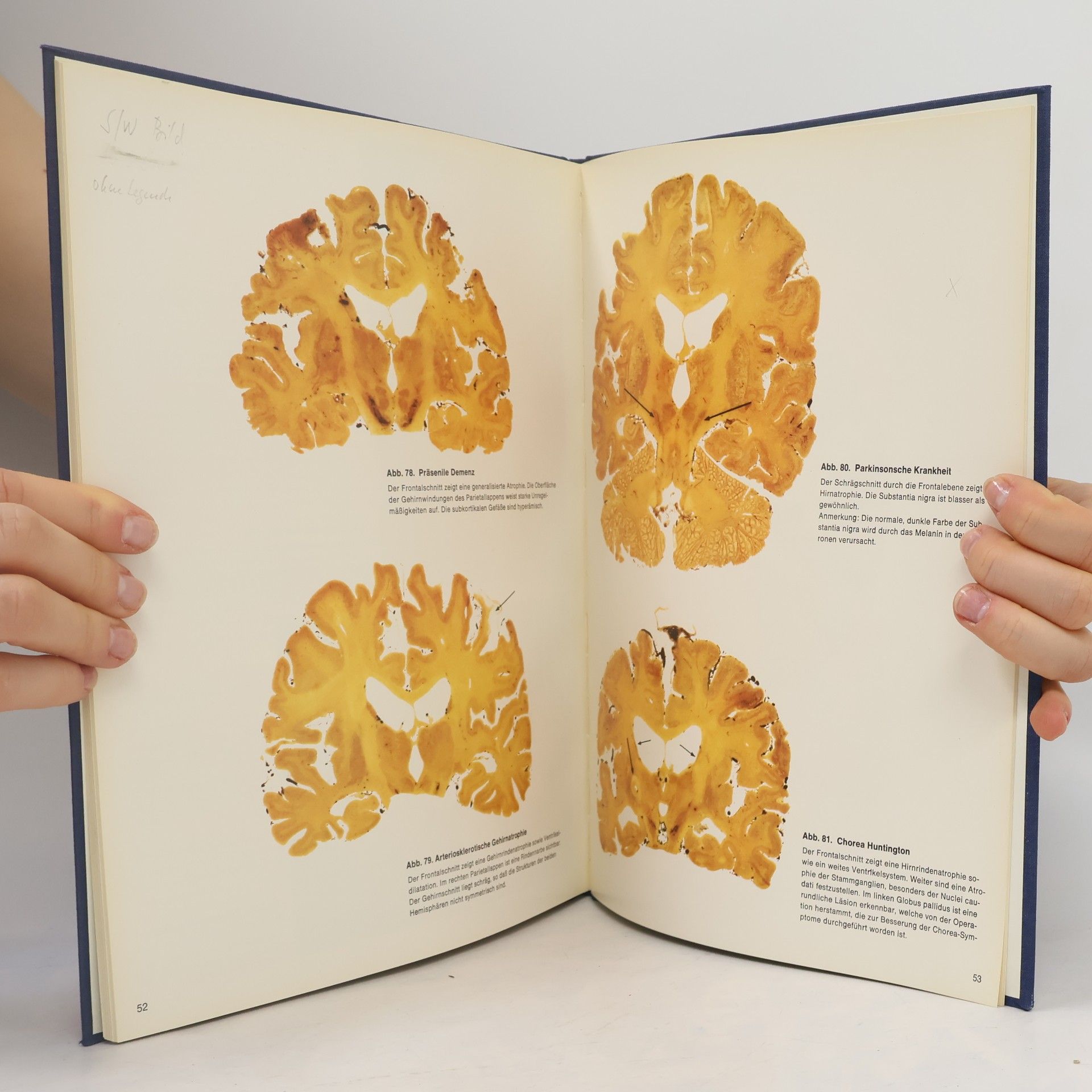 E. E. Payne Atlas zur Hirnpathologie