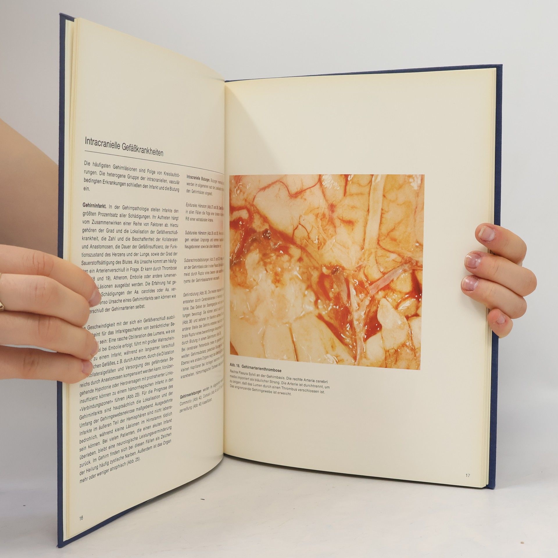 E. E. Payne Atlas zur Hirnpathologie