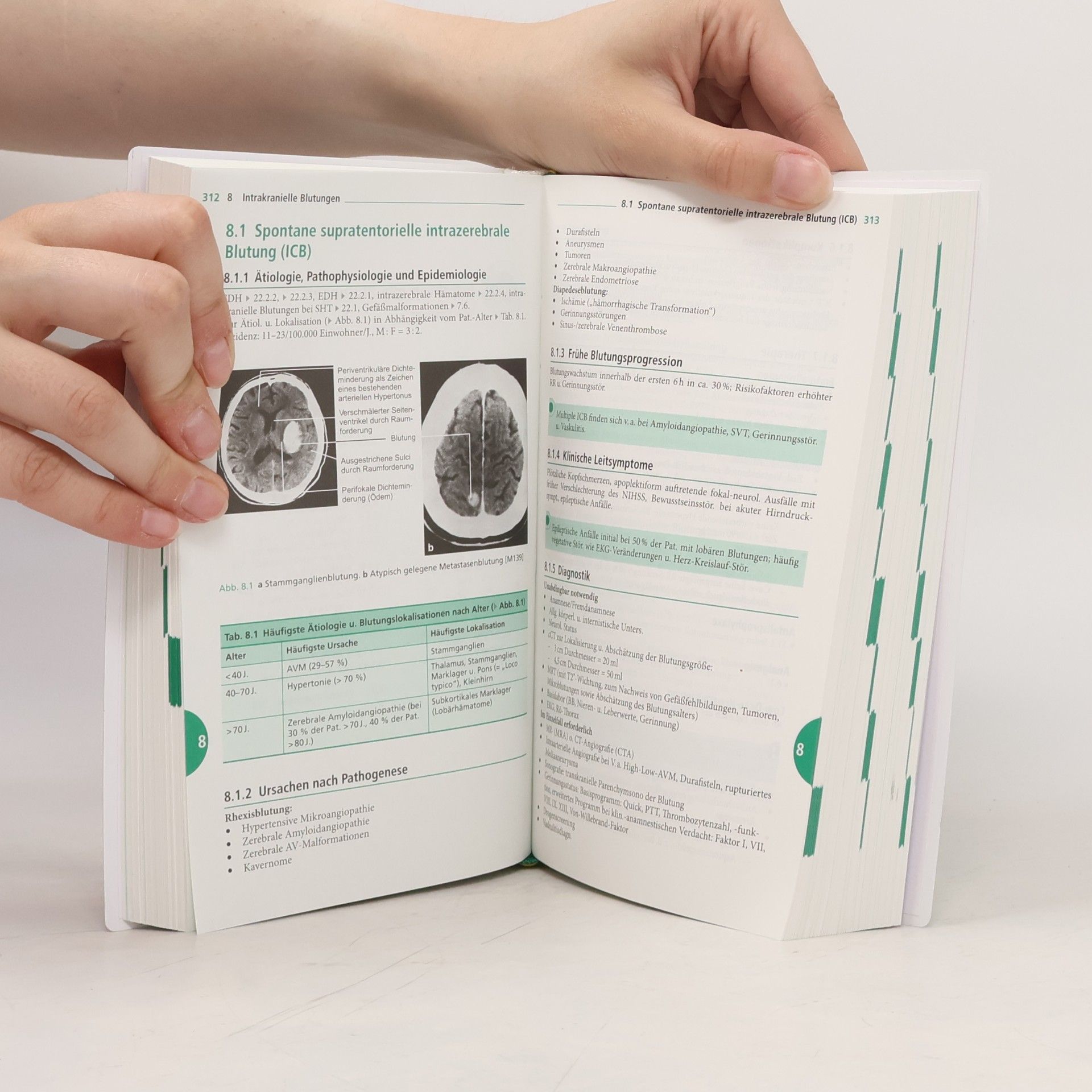 Autorenkollektiv Klinikleitfaden Neurologie