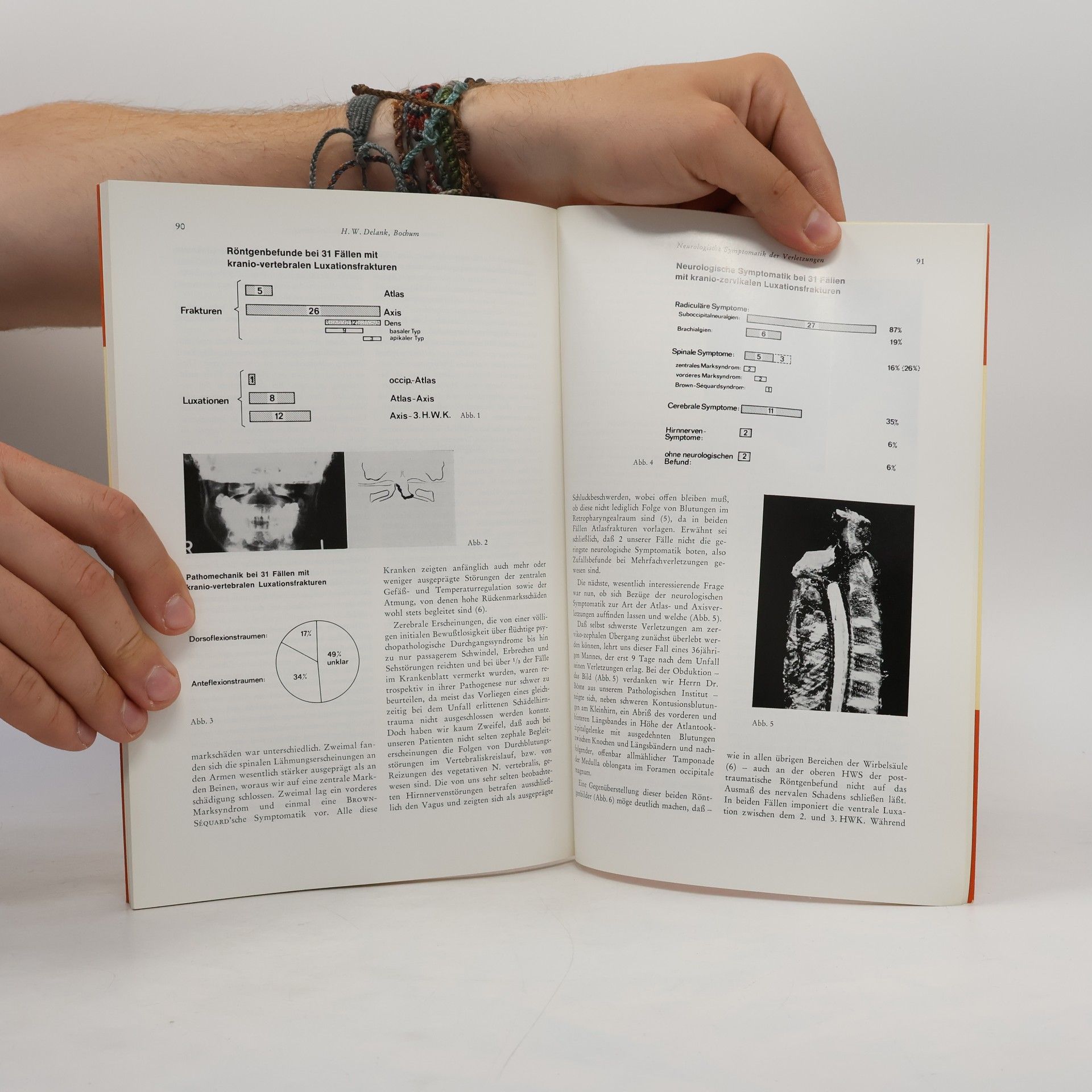 Friedrich-Wilhelm Meinecke Die Wirbelsäule in Forschung und Praxis - 76: Pathologie und Klinik der Okzipito-Zervikalregion