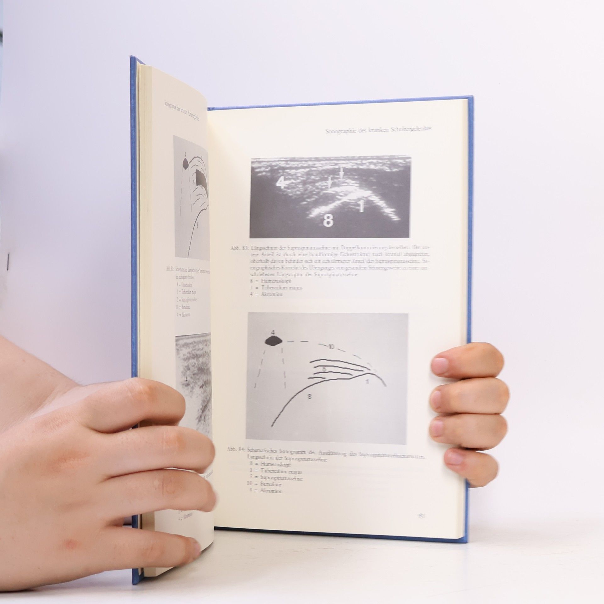 Christopher Stahl Ultraschalldiagnostik des Schultergelenkes
