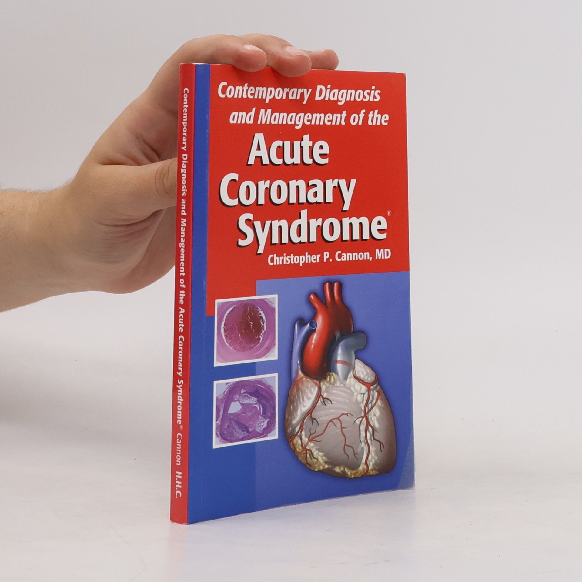 Auteurscollectief Acute Coronary Syndrome