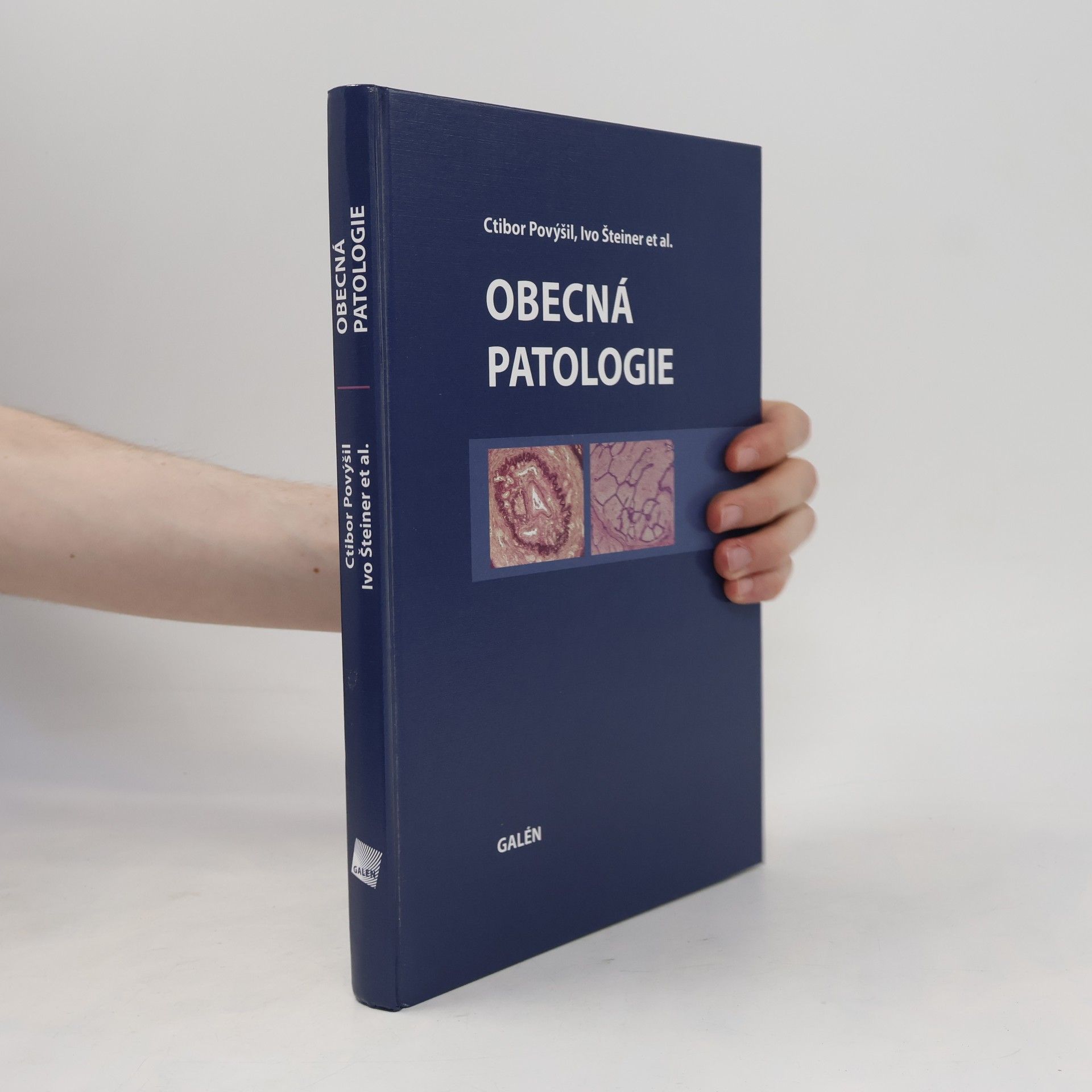 Obecná patologie