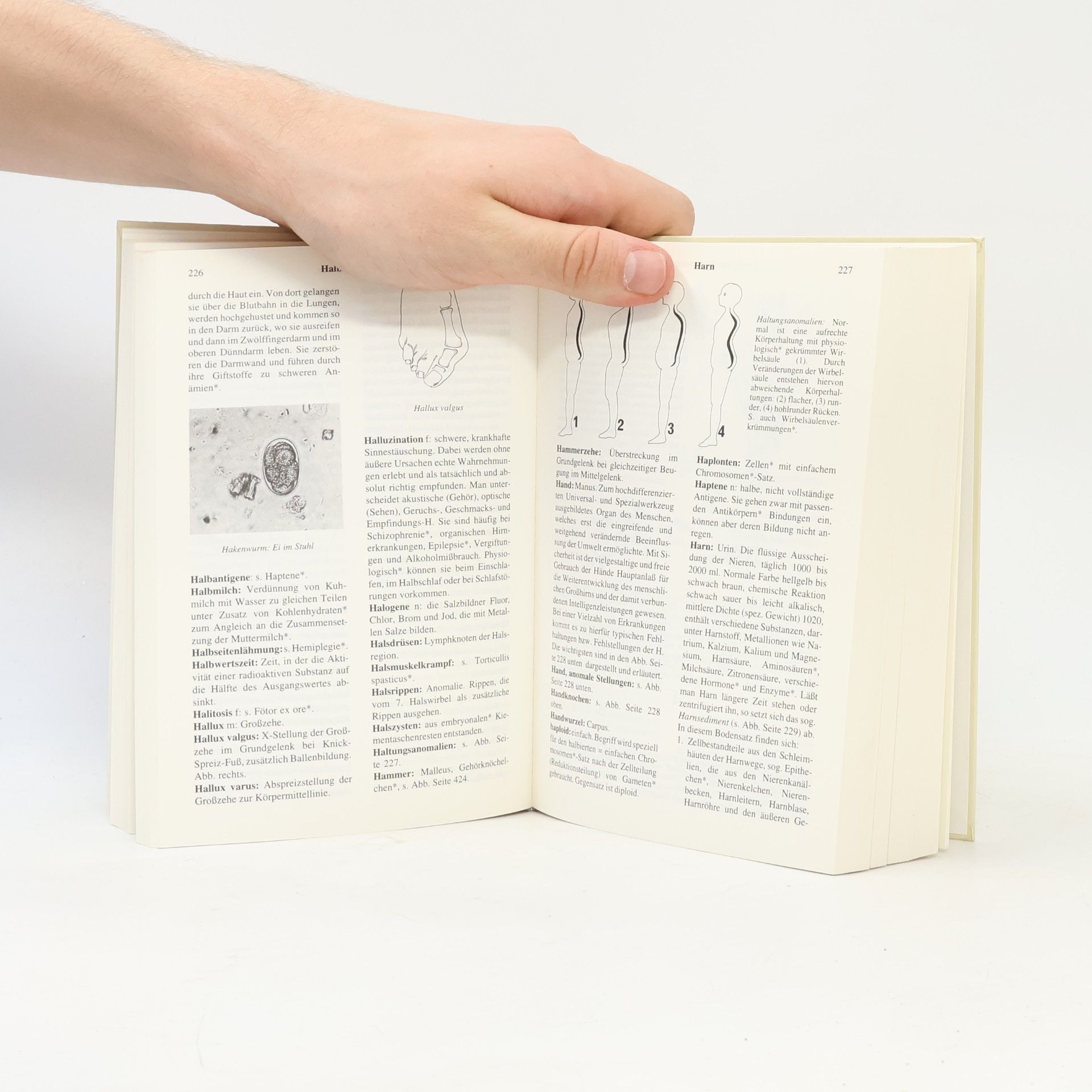 Autorenkollektiv Wörterbuch der medizinischen Fachaudrücke