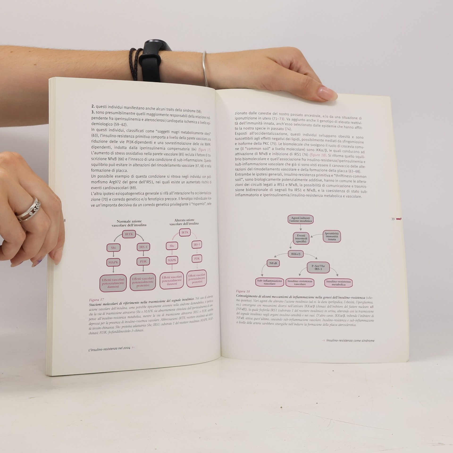 Autorenkollektiv L'insulino-resistenza nel 2004