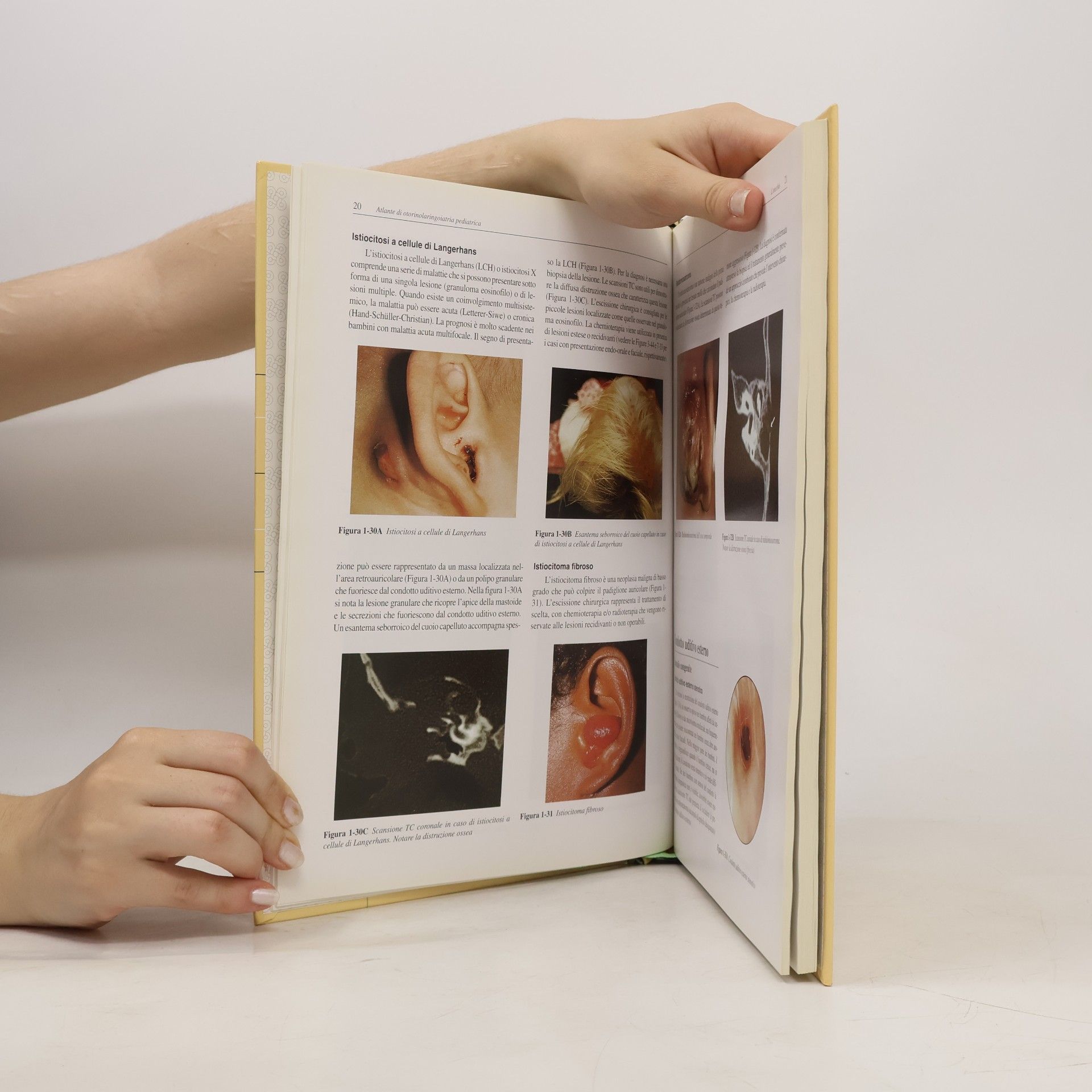 Steven D. Handler Otorinolaringoiatria pediatrica