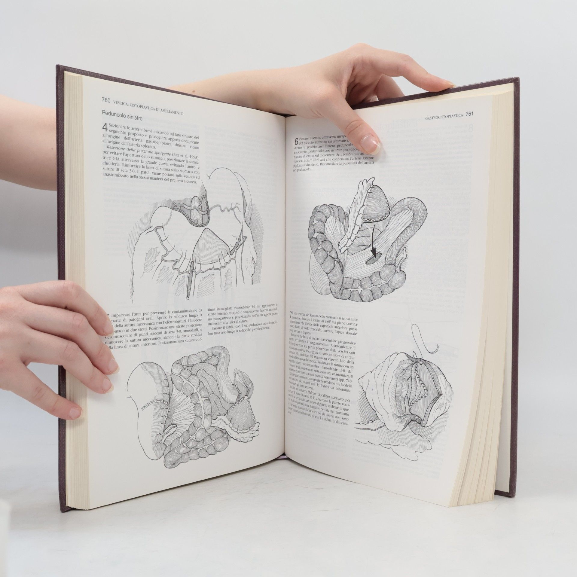 Frank Hinman Atlante di Chirurgia Urologica 2