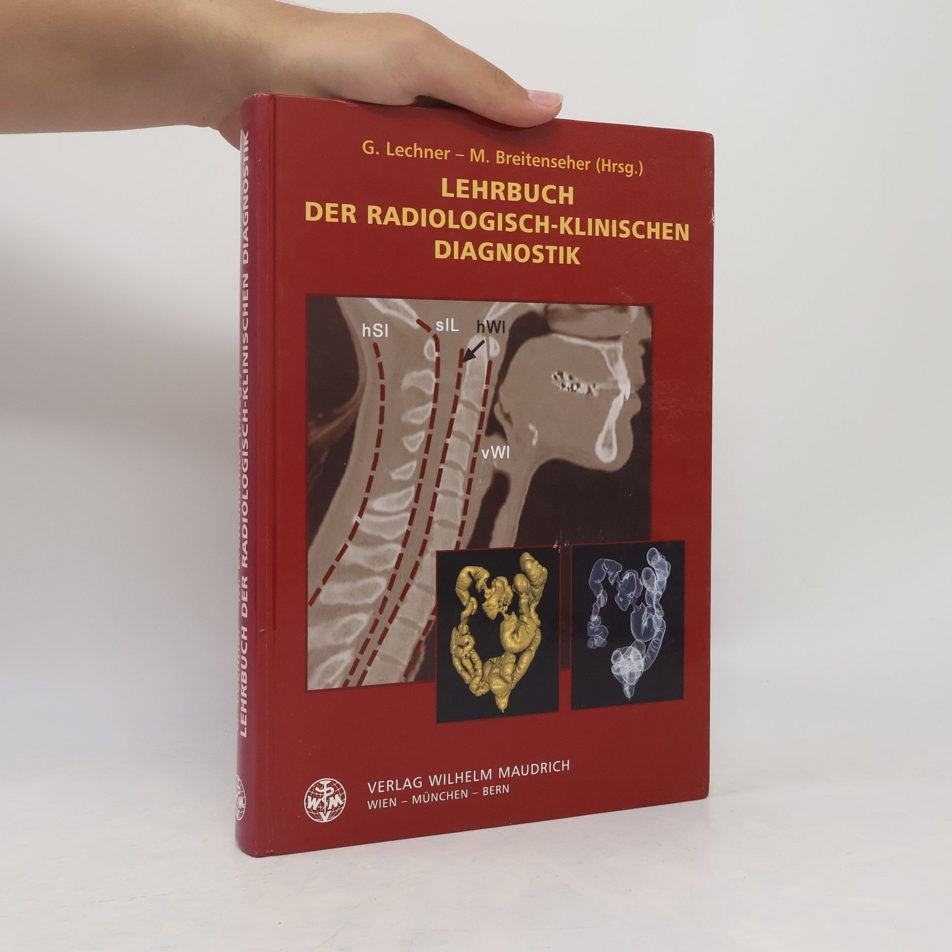 Gerhard Lechner Lehrbuch der radiologisch-klinischen Diagnostik