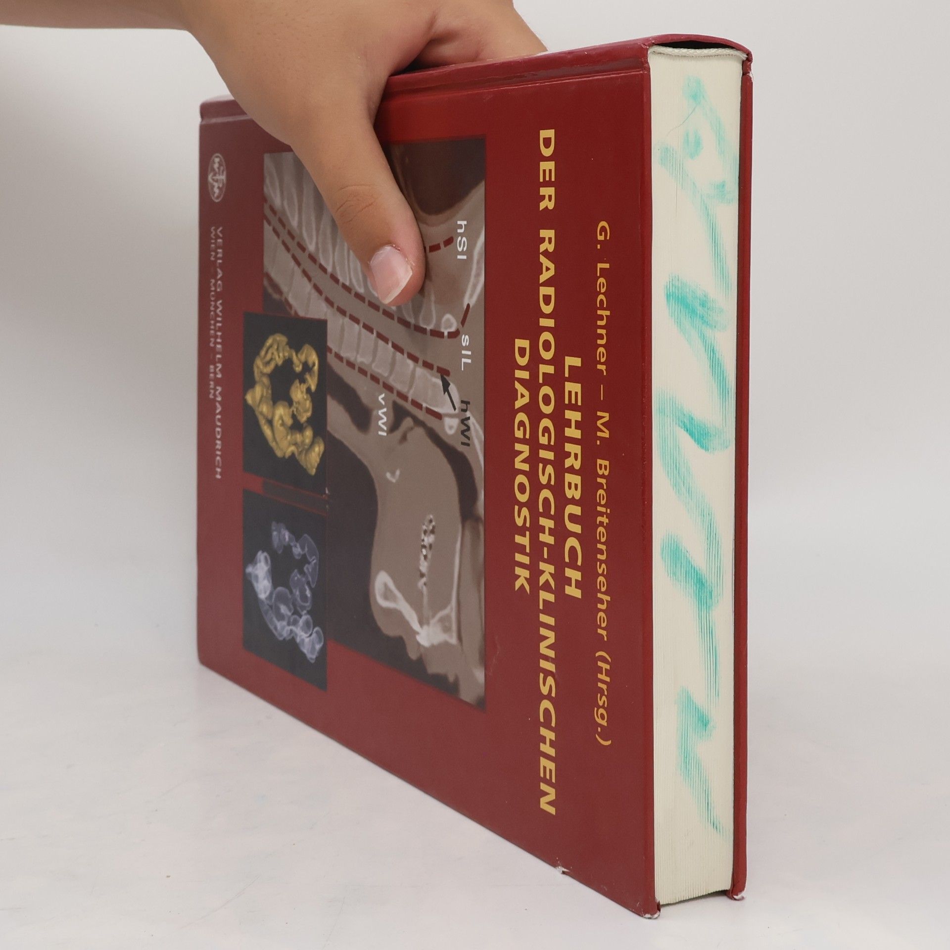 Gerhard Lechner Lehrbuch der radiologisch-klinischen Diagnostik