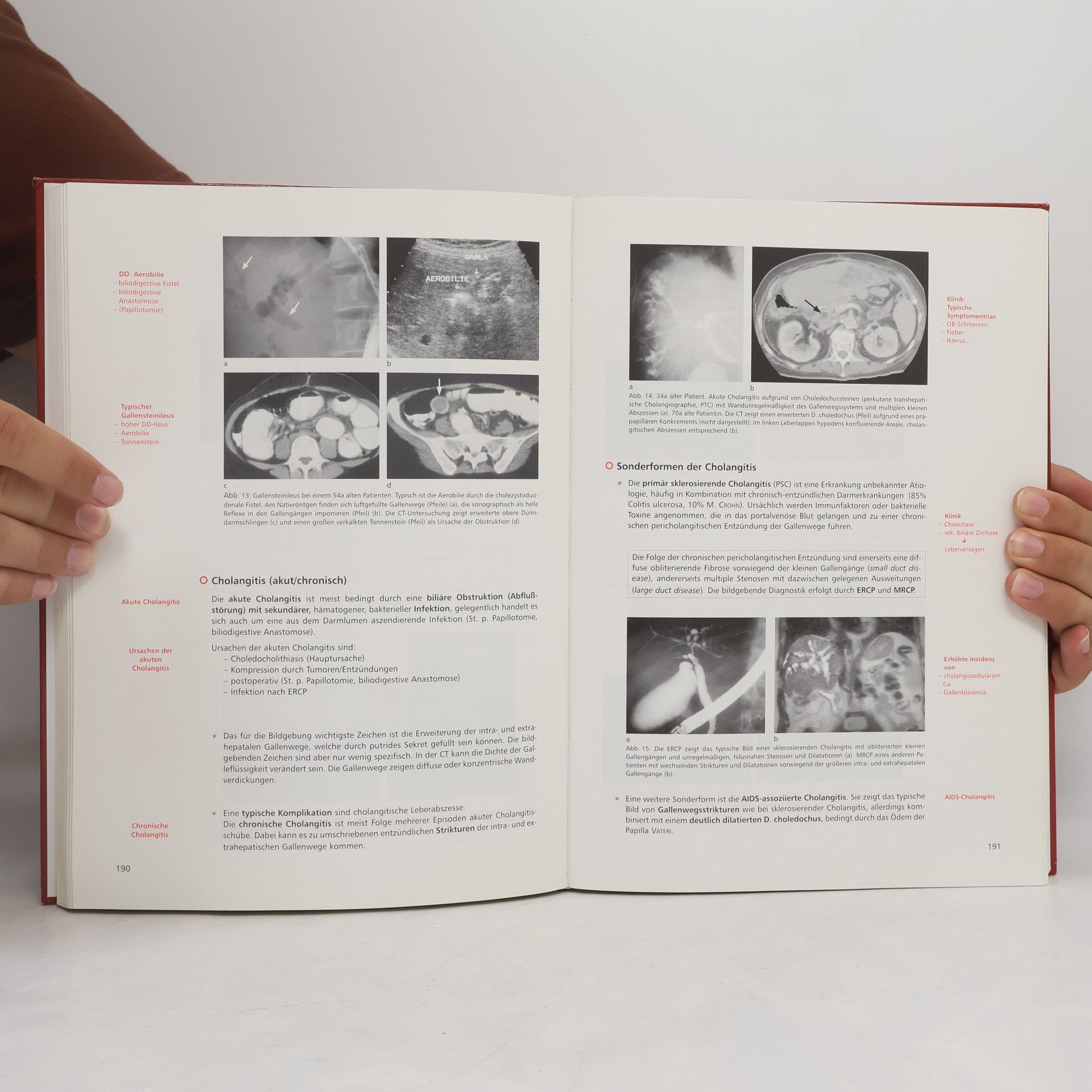 Gerhard Lechner Lehrbuch der radiologisch-klinischen Diagnostik