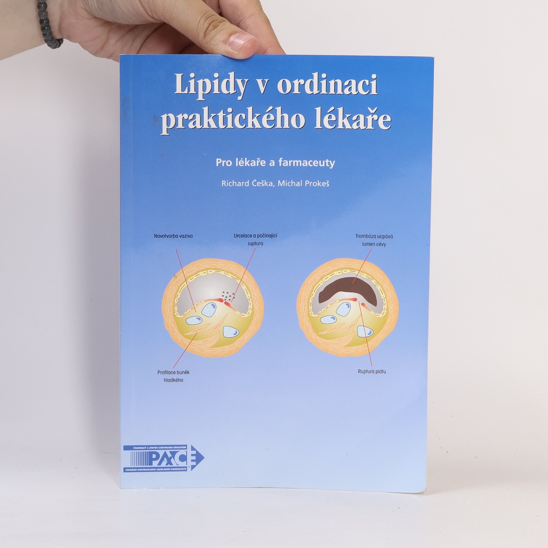 Richard Češka Lipidy v ordinaci praktického lékaře. Pro lékaře a farmaceuty