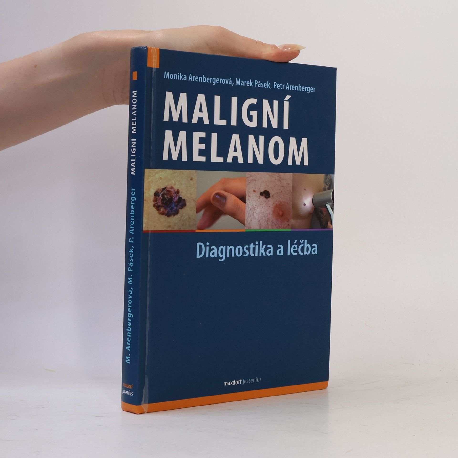 Marek Pásek Maligní melanom: diagnostika a léčba na základě aktuálního doporučeného postupu