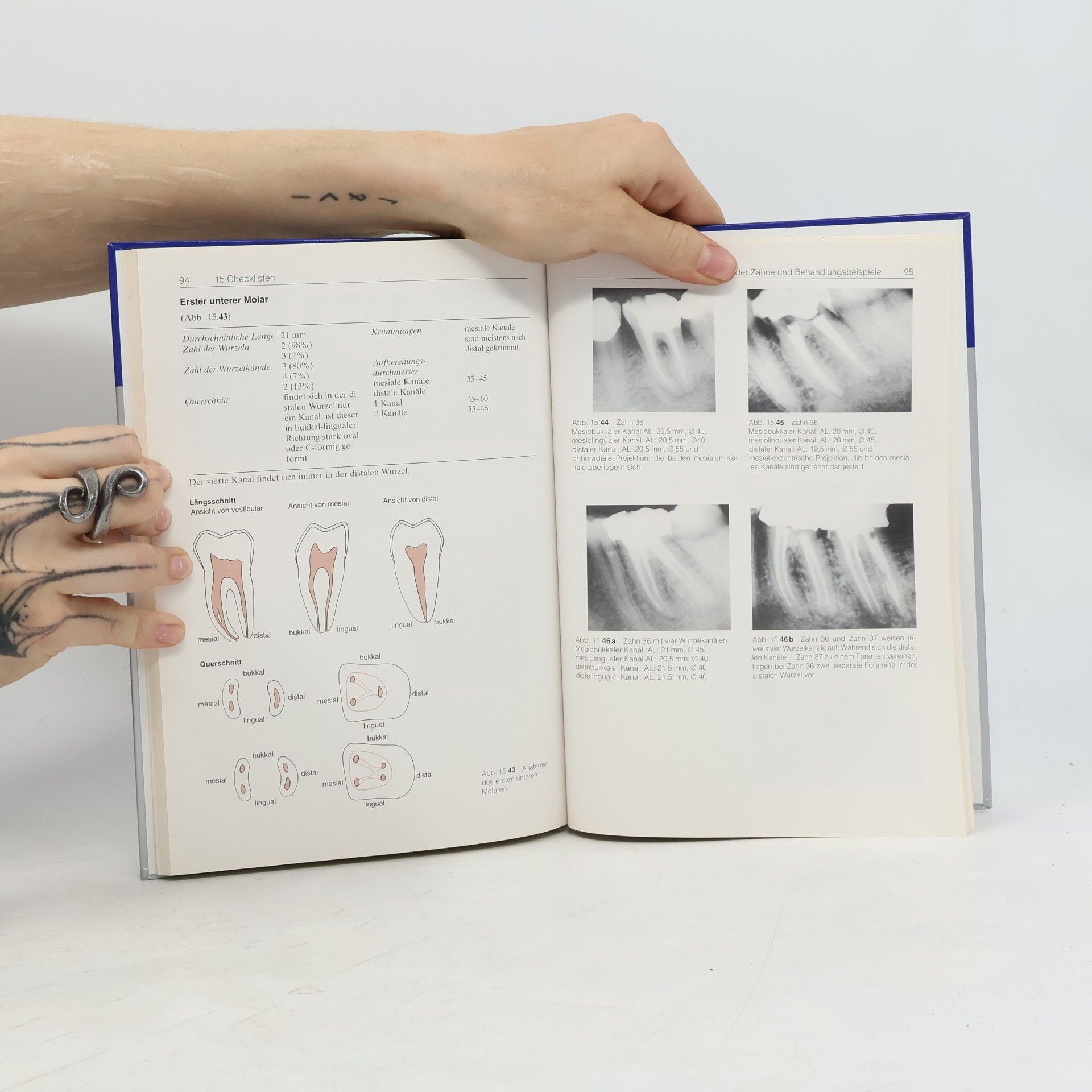 Michael Hülsmann Dent-Praxis: Endodontie