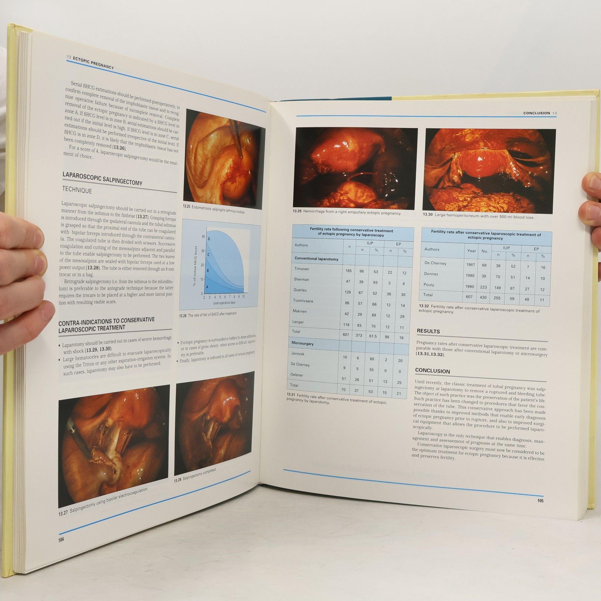 Alan G. Gordon Atlas of Gynecologic Endoscopy - Second Edition
